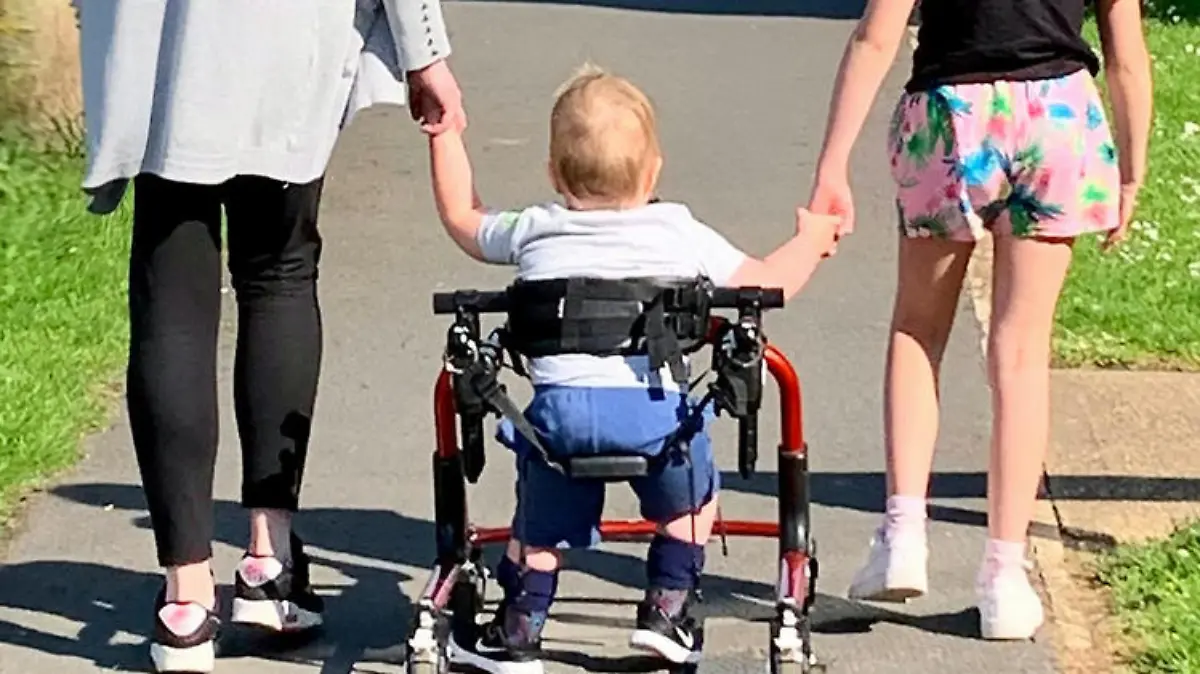 Spina Bifida