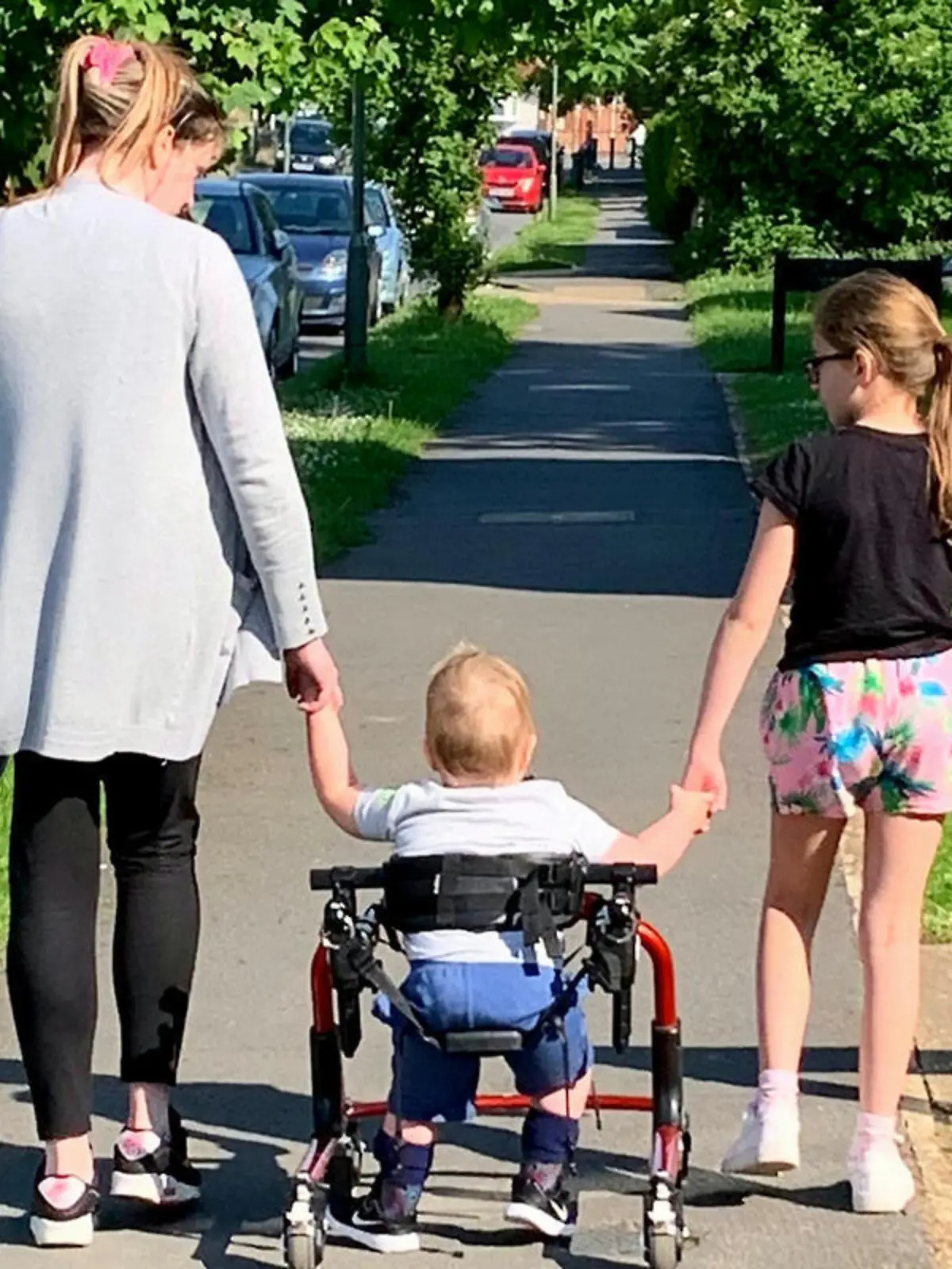 Spina Bifida
