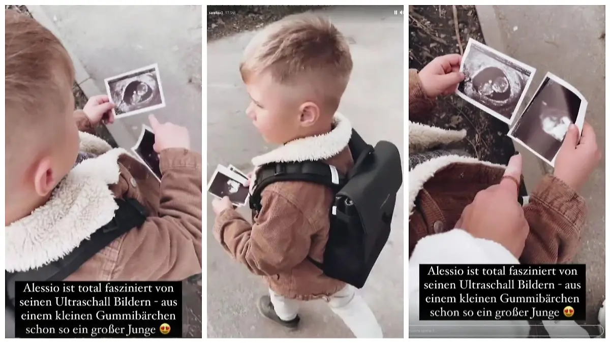 Mama Sarah zeigt ihm seine Ultraschallbilder: Alessio ist von seinen ersten Fotos fasziniert!