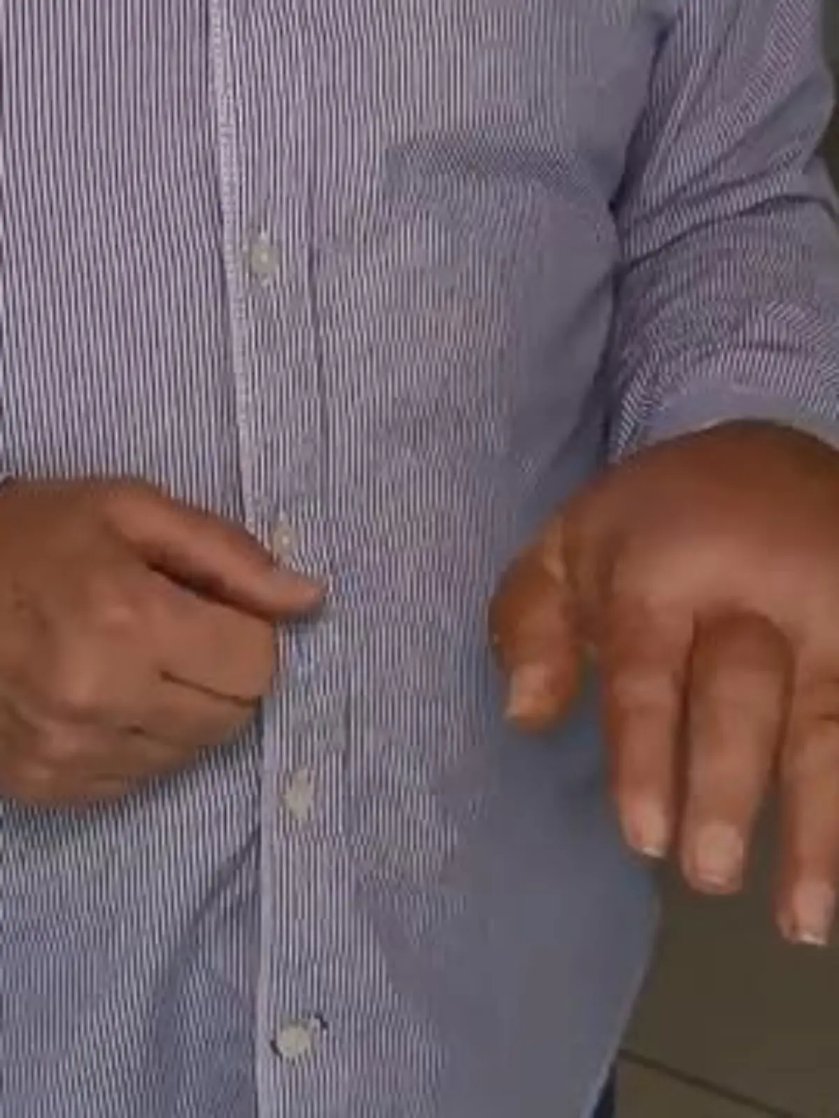 Bild zu: "Kölner hat extrem geschwollene Hand"