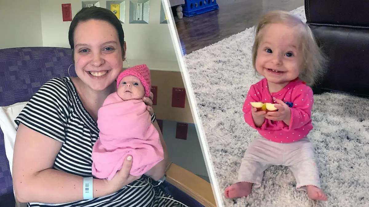 Die kleine Abigail kam mit einer seltenen Form des Kleinwuchses zur Welt.