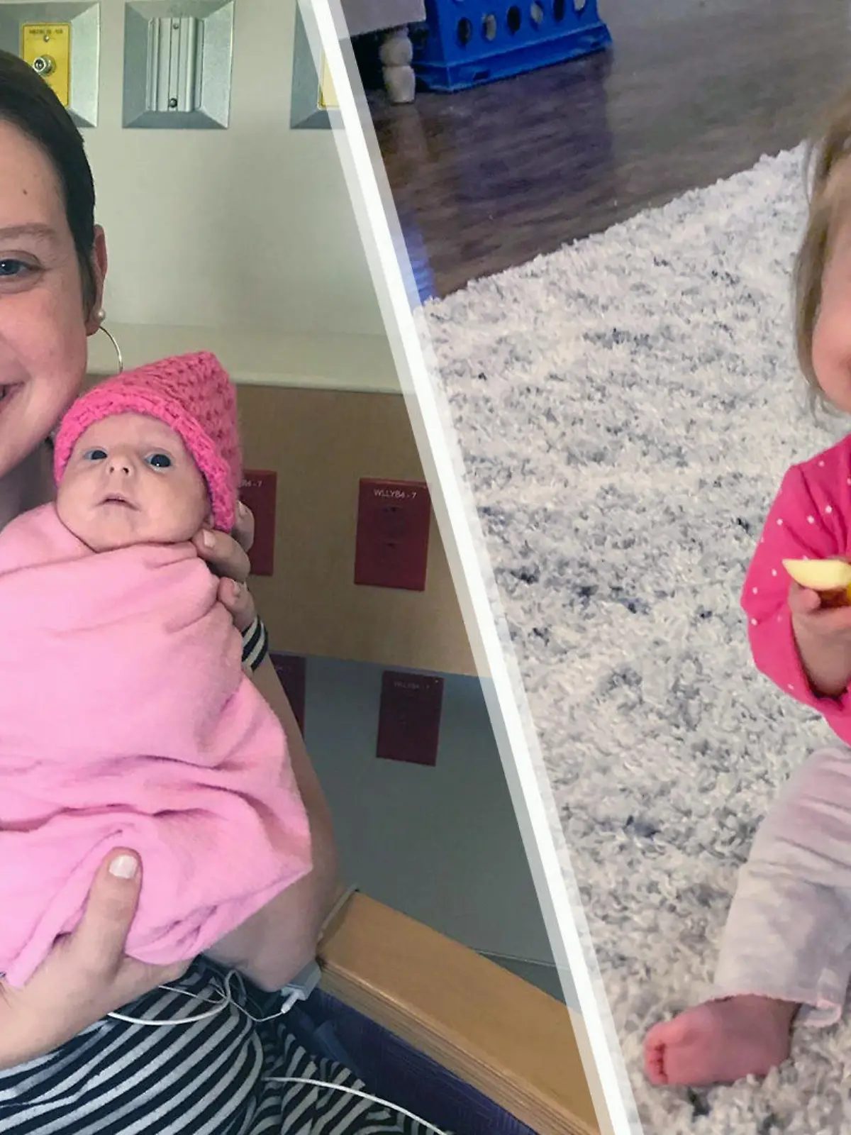 Die kleine Abigail kam mit einer seltenen Form des Kleinwuchses zur Welt.