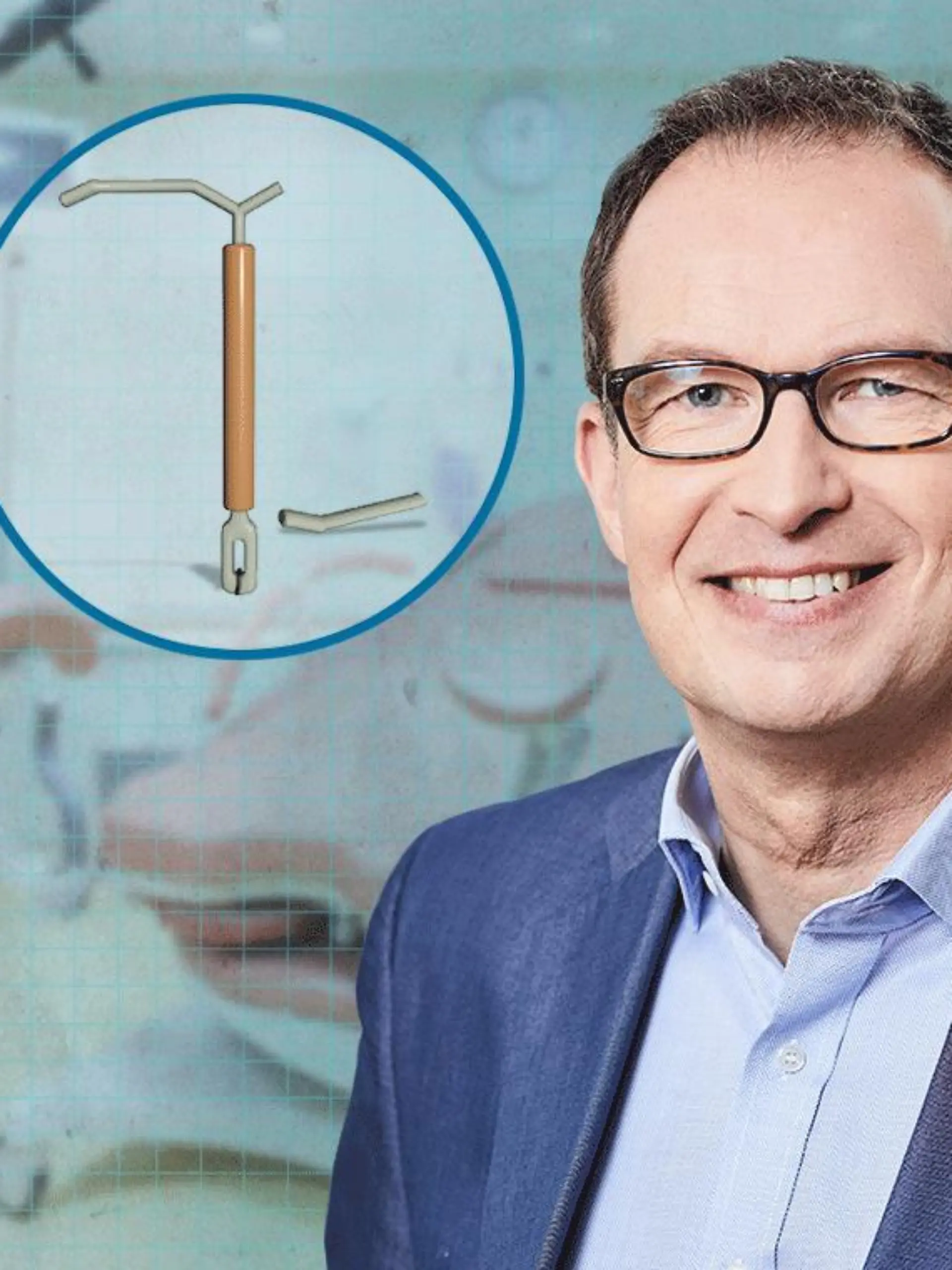 Ungewollt schwanger weil Spirale gebrochen ist. Das sagt. Dr. Specht dazu.