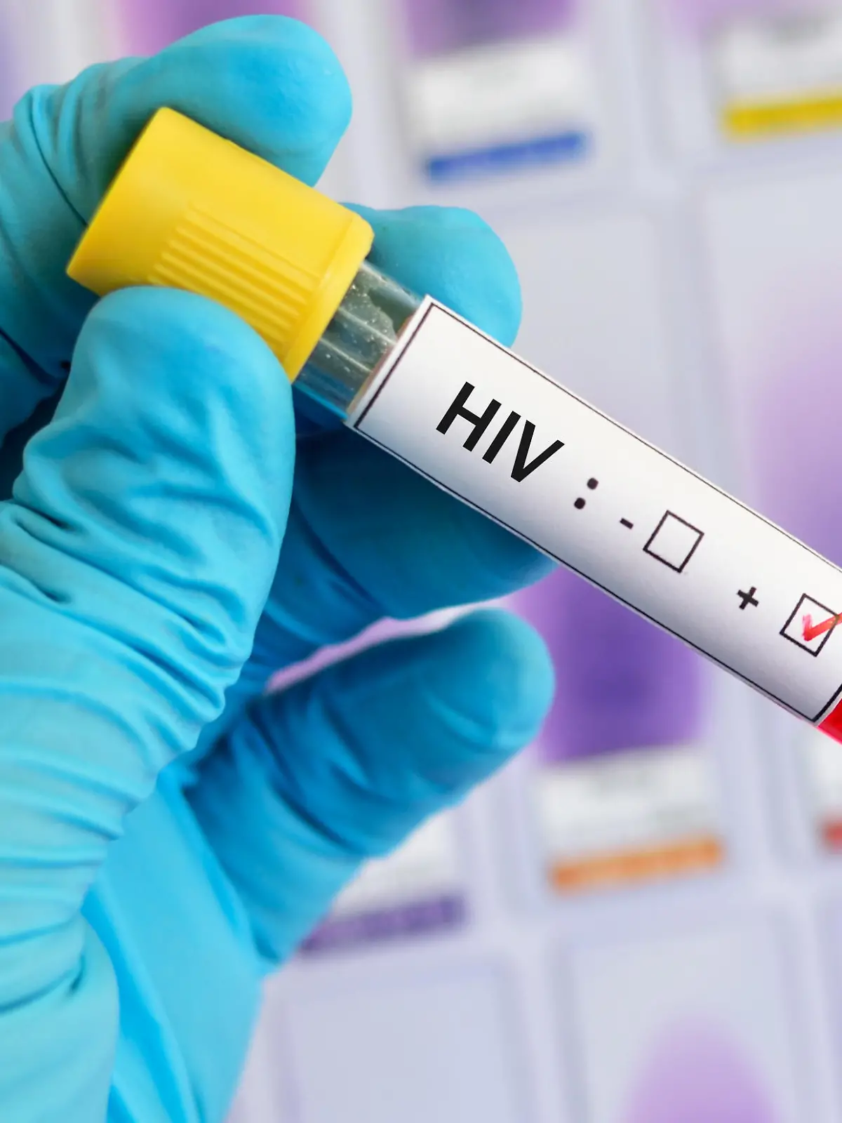 positiver HIV-Test