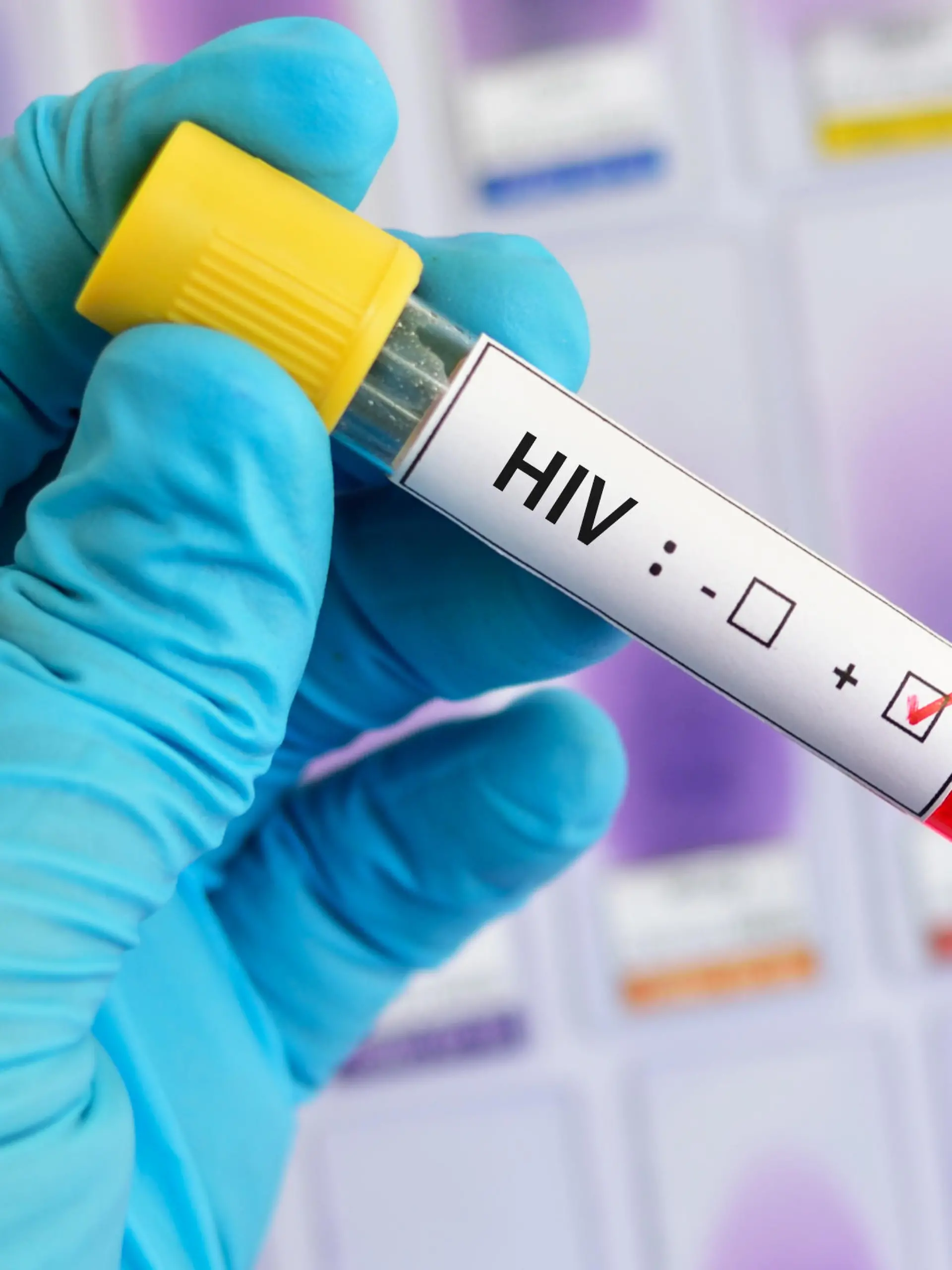 positiver HIV-Test
