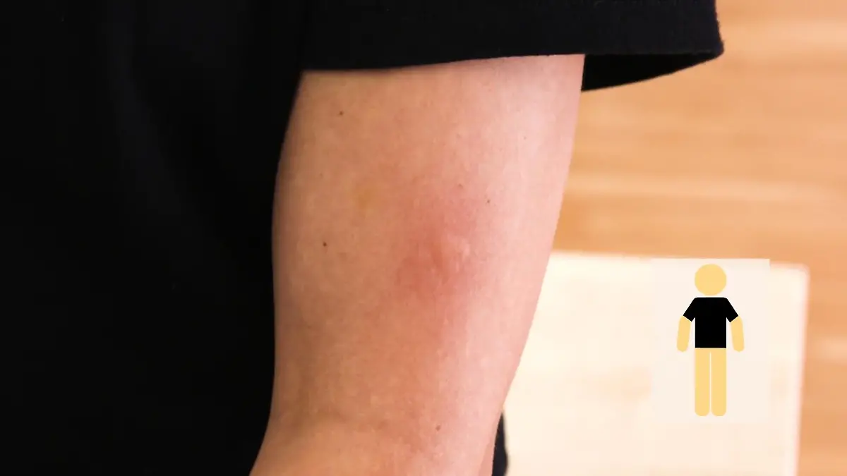 Schweiß, Kleidung & Co.: Wann stechen Mücken am liebsten zu? 4 Mücken-Mythen im Faktencheck