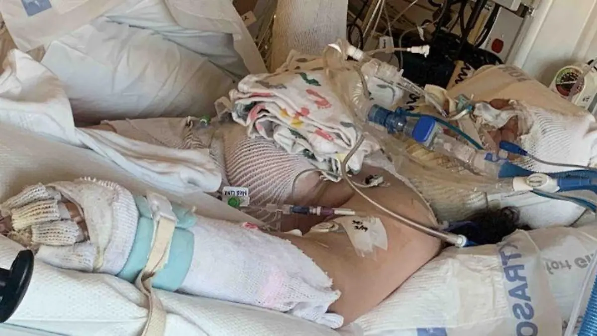 Die 13-jährige Destini Crane aus Portland, Oregon in den USA verletzte sich schwer bei dem Versuch, eine TikTok-Video nachzuahmen.