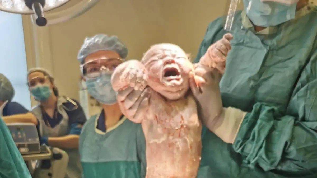 Auf dem Foto erkennt man, wie Ärzte ein Baby nach der Geburt hochhalten, das überdurchschnittlich Groß ist.