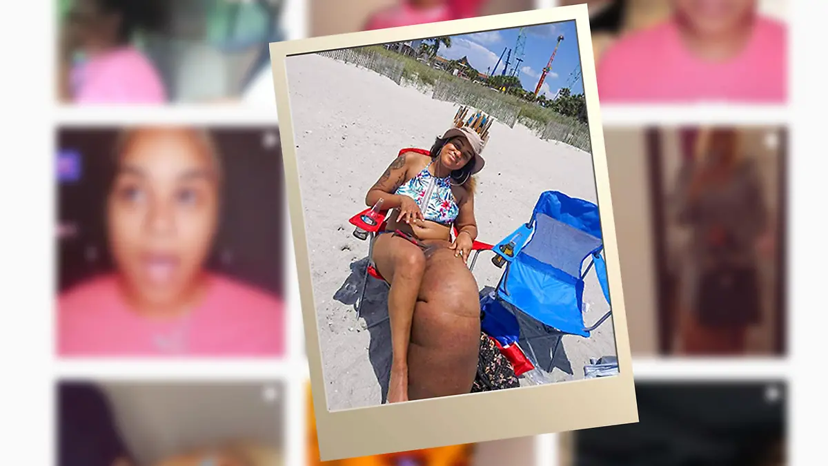 Mahogany Geter entspannt trotz Elephantiasis am Strand