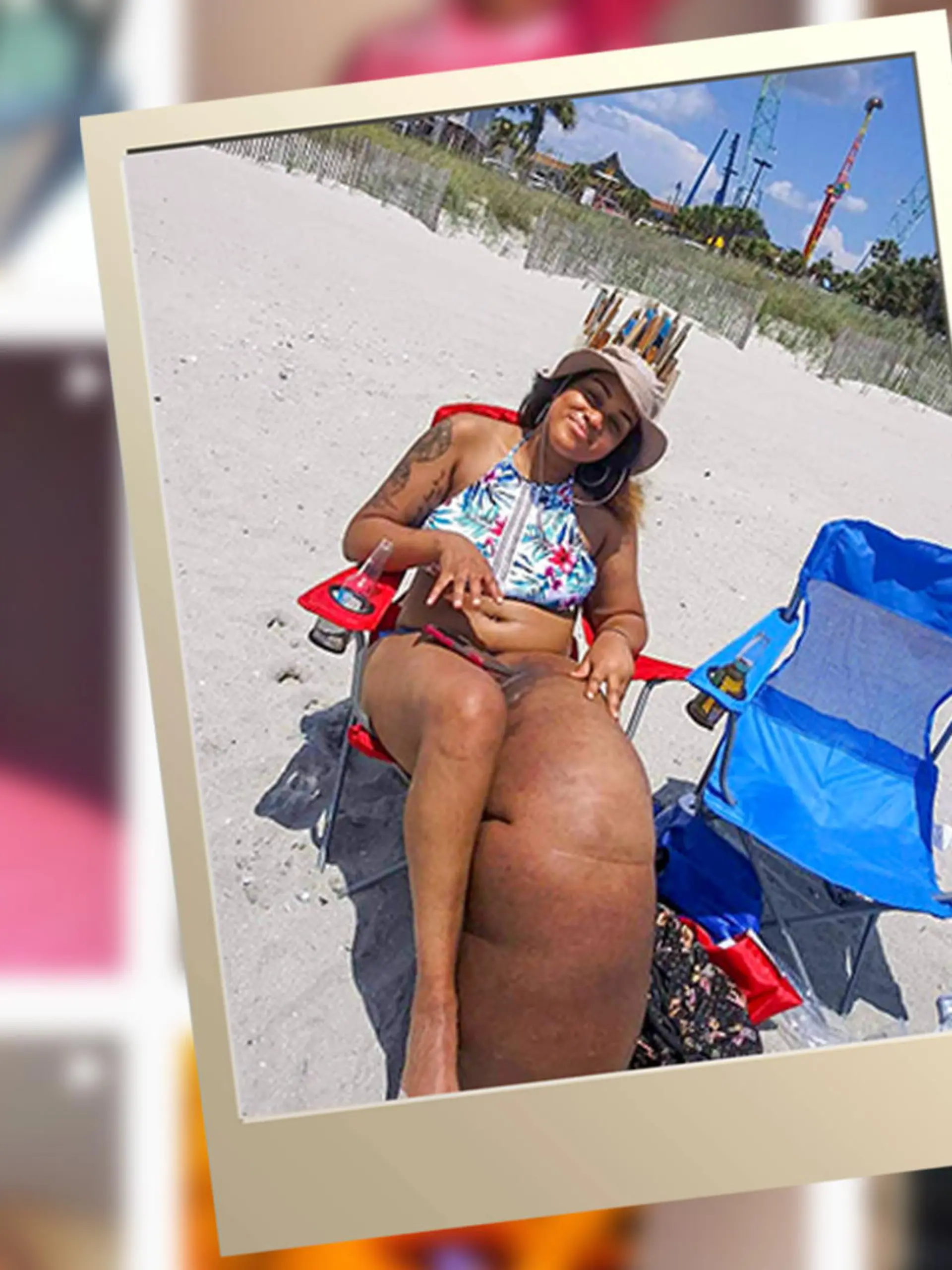 Mahogany Geter entspannt trotz Elephantiasis am Strand