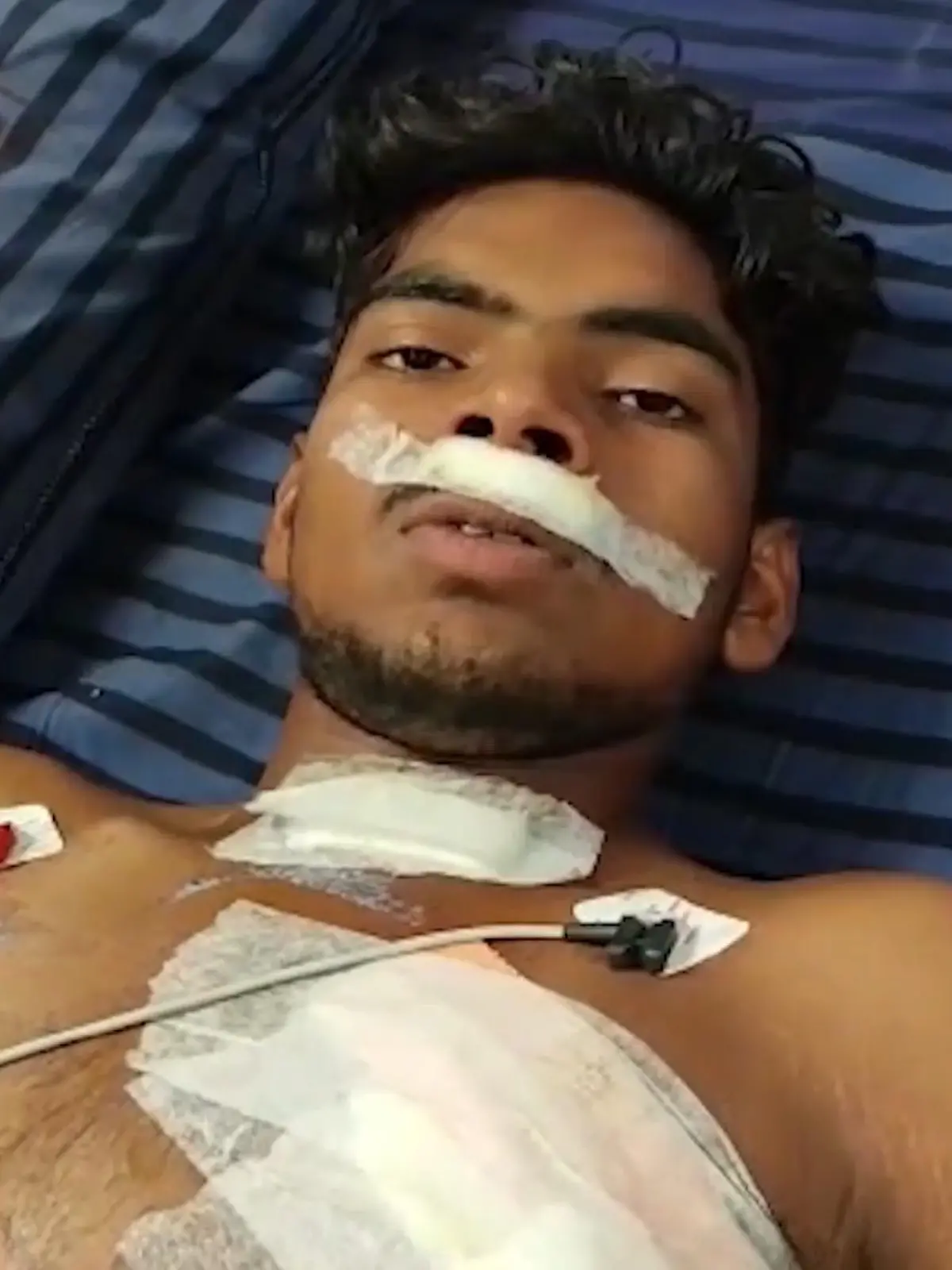 Der 18-jährige Shivam war mit seinem Motorrad im indischen Sagar unterwegs, als er mit einem Ochsenkarren zusammenprallte. Daraufhin bohrte sich der Balken durch seine Brust.