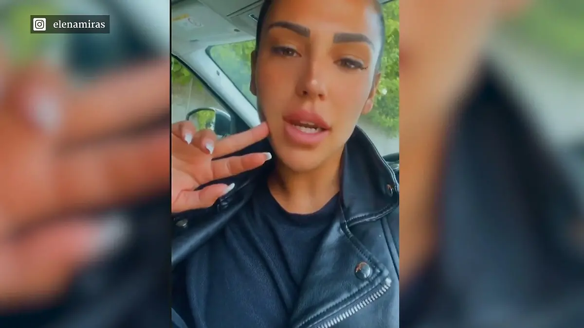 Nach Brust-OP: Elena Miras' Narbe hat sich entzündet Komplikation nach dem Eingriff