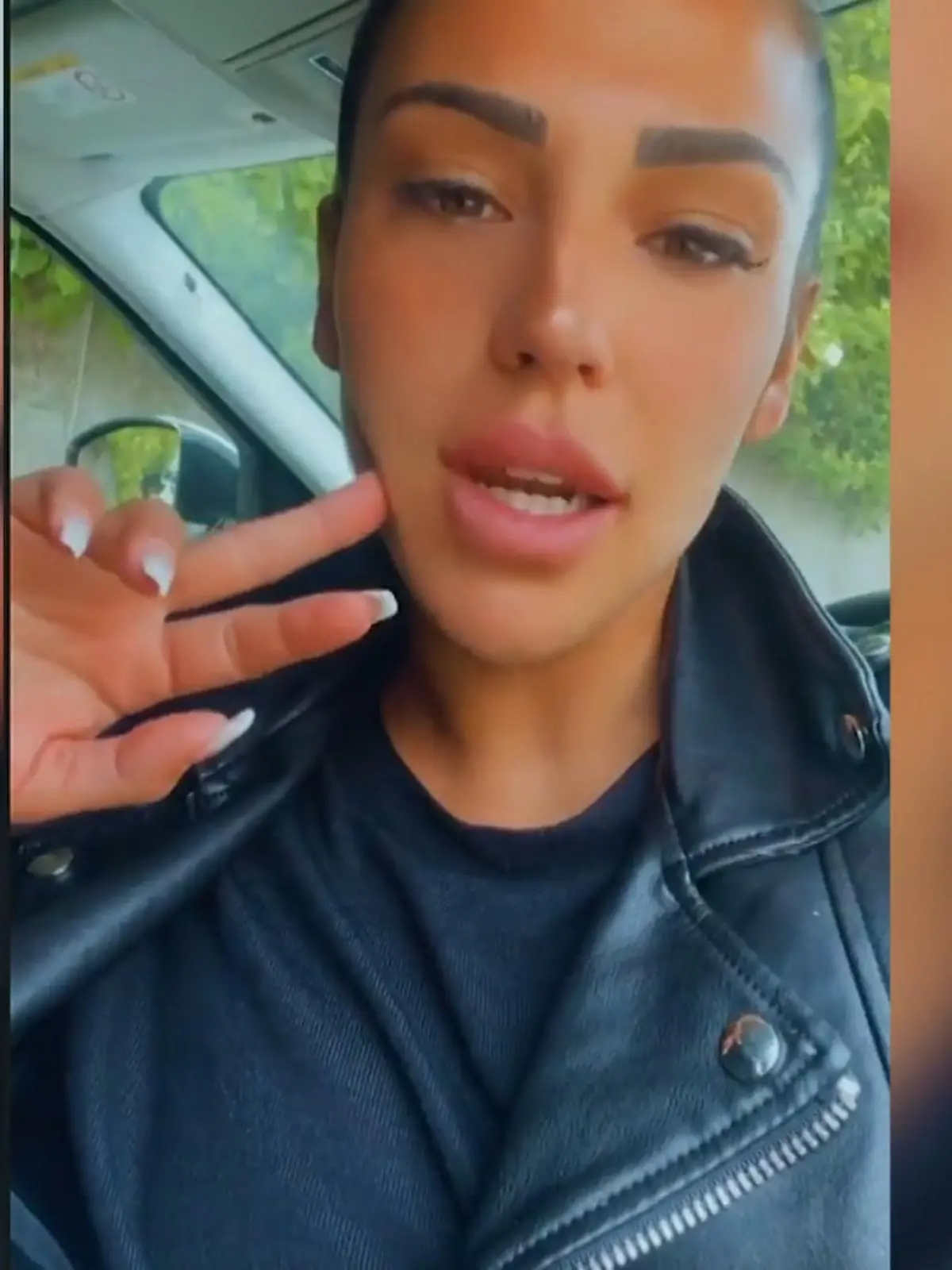 Bild zu: "Nach Brust-OP: Elena Miras' Narbe hat sich entzündet"
