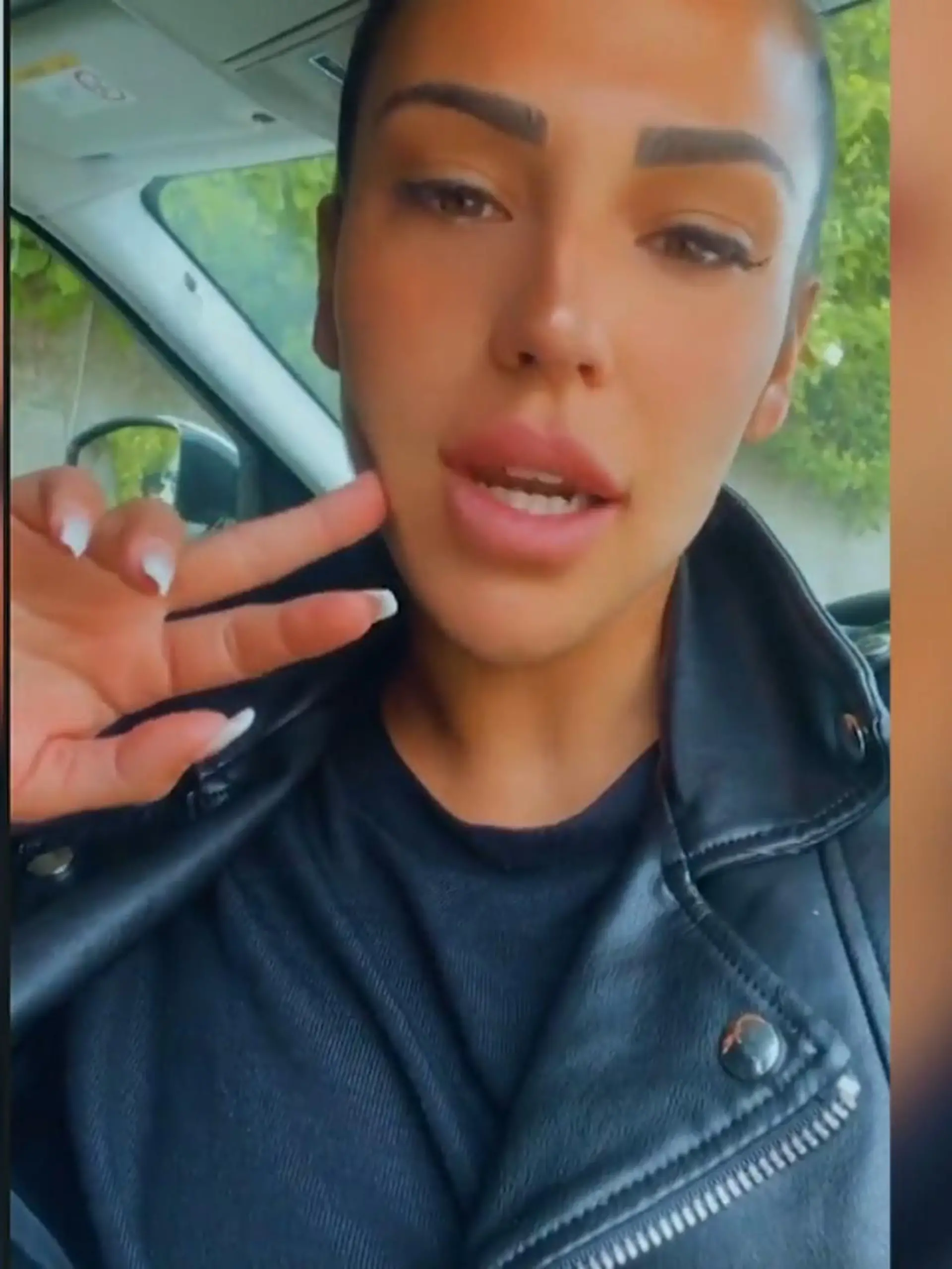Bild zu: "Nach Brust-OP: Elena Miras' Narbe hat sich entzündet"