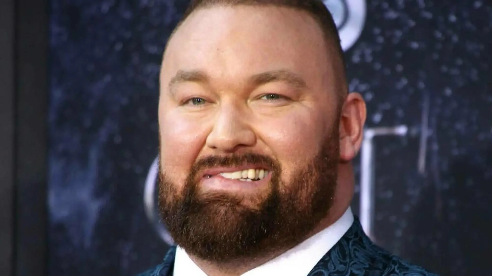 50 Kilo leichter: "GoT"-Star Hafthor Björnsson kaum wiederzuerkennen