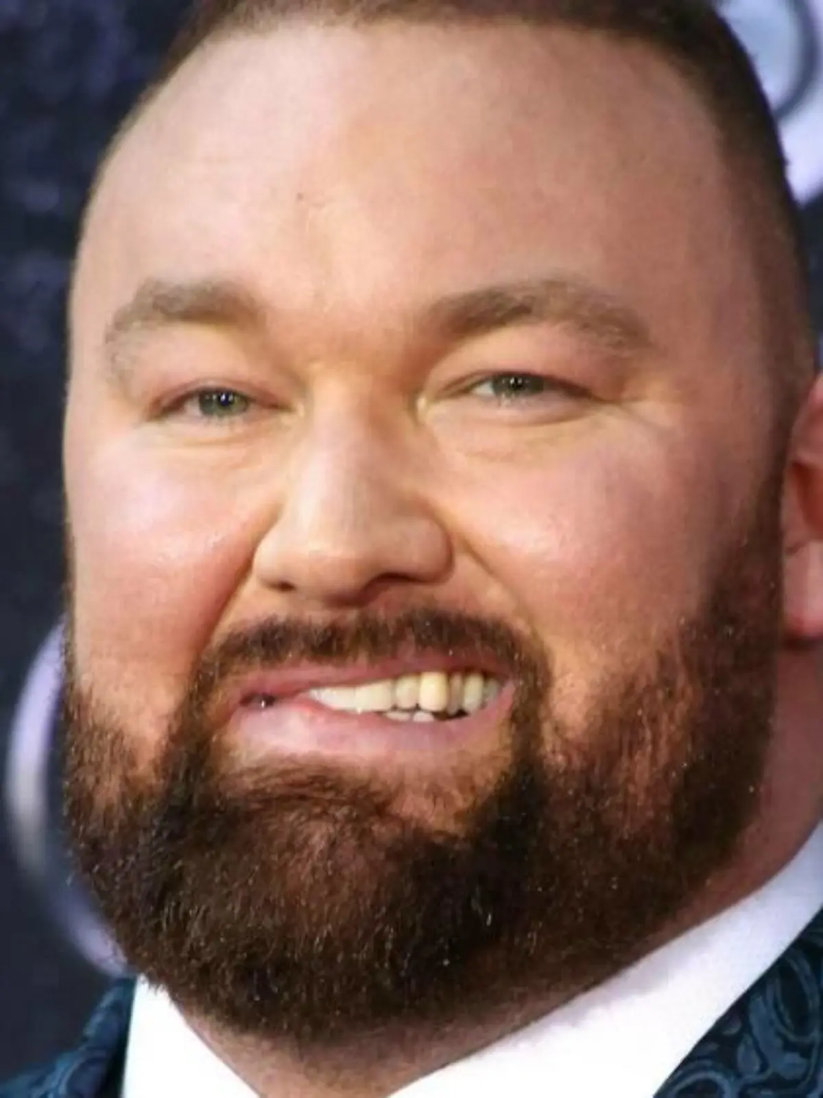 50 Kilo leichter: "GoT"-Star Hafthor Björnsson kaum wiederzuerkennen