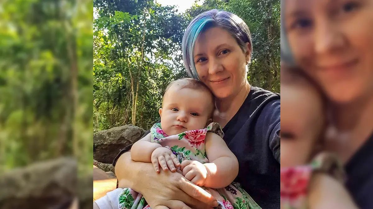 Megin Davies (40) zeigt ihre Narbe