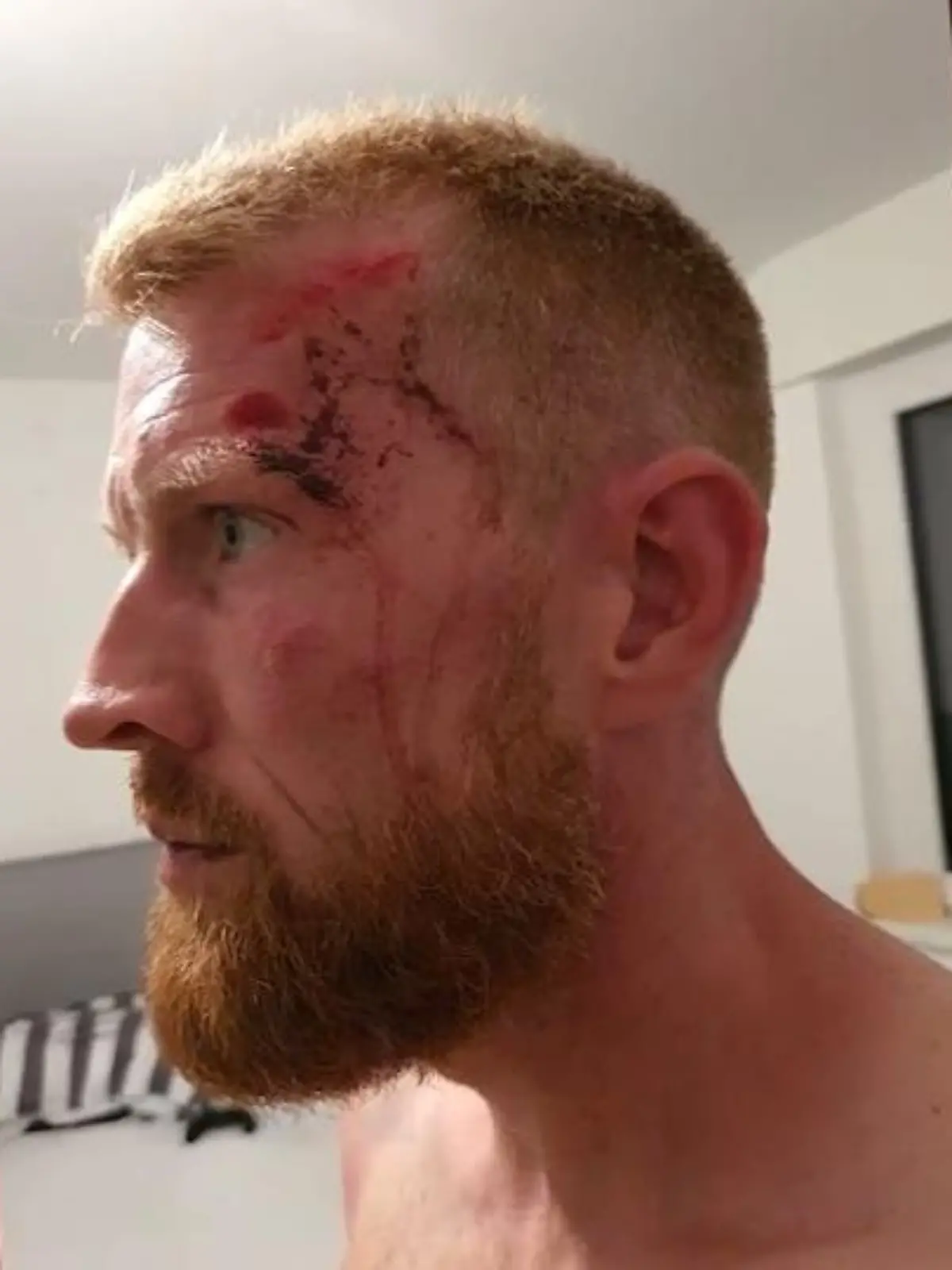 Er soll von mehreren Polizisten festgehalten, verprügelt und gewürgt worden sein: Liam Conway, Kampfsporttrainer aus Idstein, erhebt nach einem Vorfall im September 2020 schwere Vorwürfe gegen die Beamten. Der größte Skandal: Das Überwachungsvideo, das seine Unschuld beweisen könnte, wurde angeblich von der Polizei gelöscht. Was diese zu den Anschuldigungen sagt und wie Liam Conway Gerechtigkeit erreichen möchte – im Video.