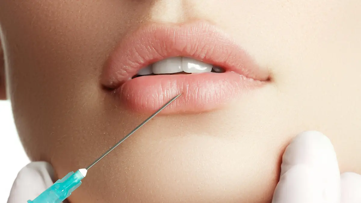 Lippen aufspritzen