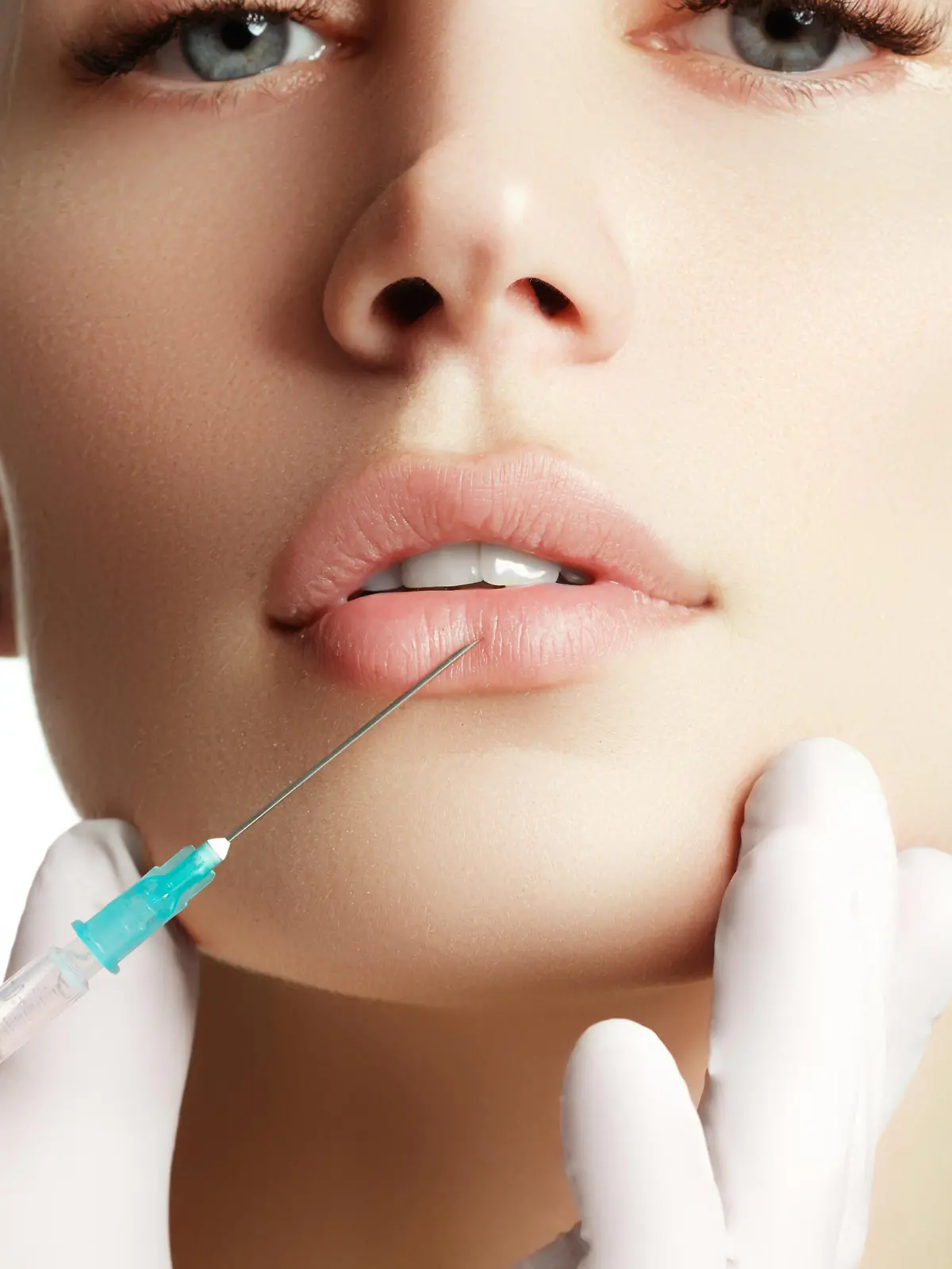 Lippen aufspritzen