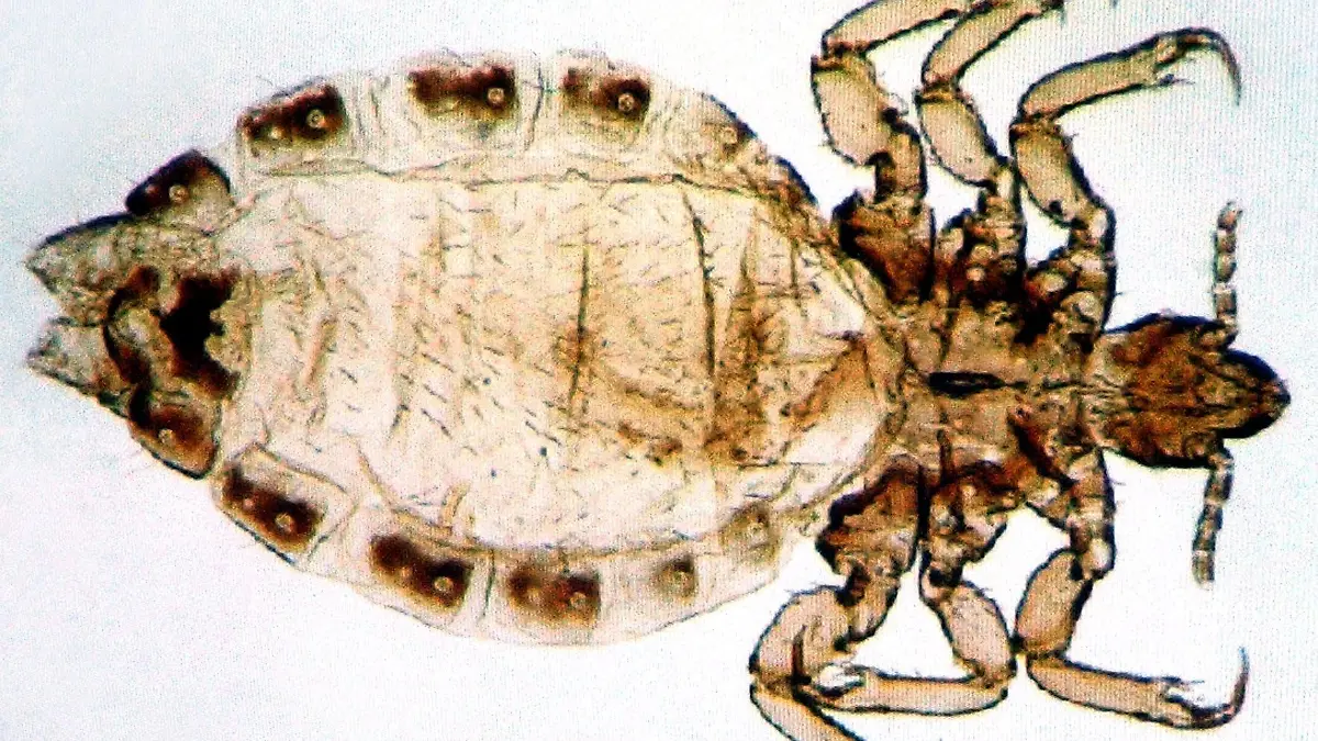 Leipzig (Sachsen): Auf einem Computerbild im Max-Planck-Institut in Leipzig ist am 18.08.2003 eine Kopflaus vom Menschen (Pediculus humanus) abgebildet. Eine Wissenschaftlergruppe des Institutes für Evolutionäre Anthropologie hat bei Genuntersuchungen an Läusen die Entstehungszeit der menschlichen Kleidung herausgefunden. Danach haben unsere Vorfahren erst vor etwa 110.000 bis 30.000 Jahren damit begonnen, Kleidung zu tragen. Die Untersuchungen gehen aus einem vorab veröffentlichten Bericht des US-Fachjournals "Current Biology" hervor. (LEI03-180803)