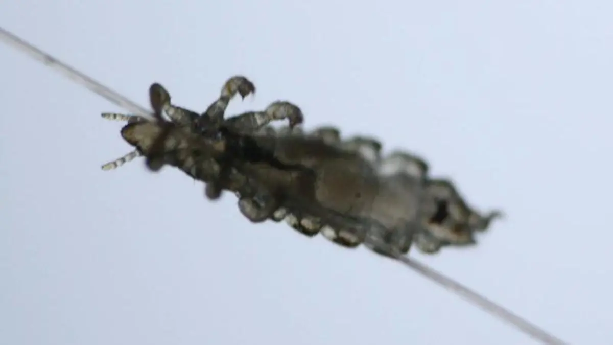 So sieht sie aus: Die meisten Menschen assoziieren Läuse mit Schmutz und ungewaschenen Haaren. Dabei hat Kopflaus-Befall nichts mit mangelnder Hygiene zu tun. Foto: Deutsche Pediculosis Gesellschaft e.V.