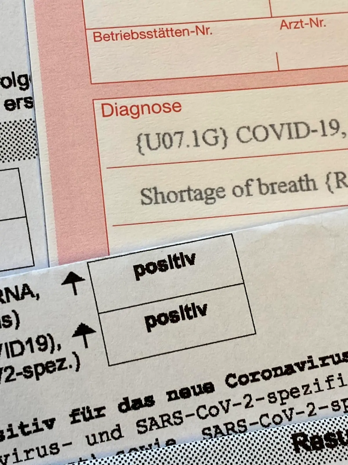 Postives Corona-Testergebnis