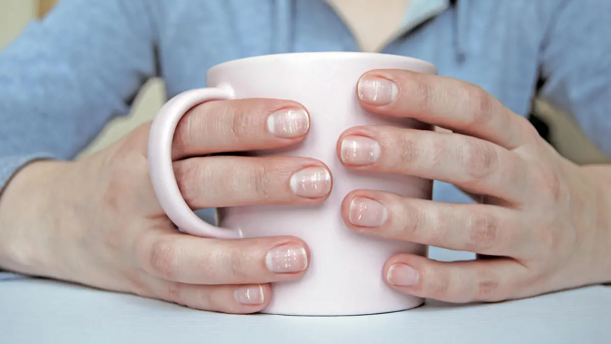 Zwei Hände halten eine Tasse. Man sieht verschiedene Linien und Punkte auf den Fingernägeln.