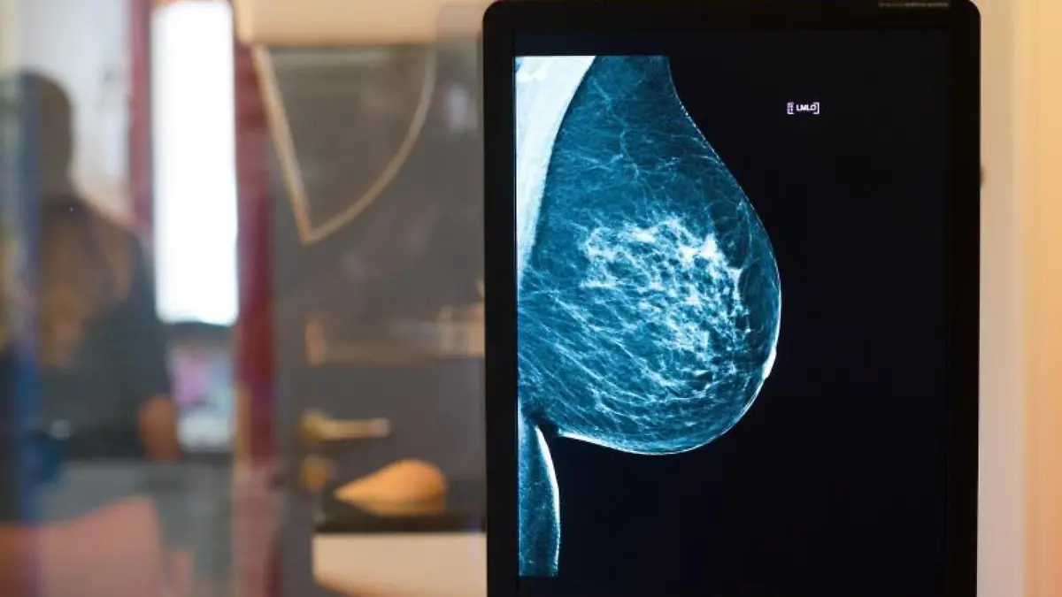 Mammographie-Screening