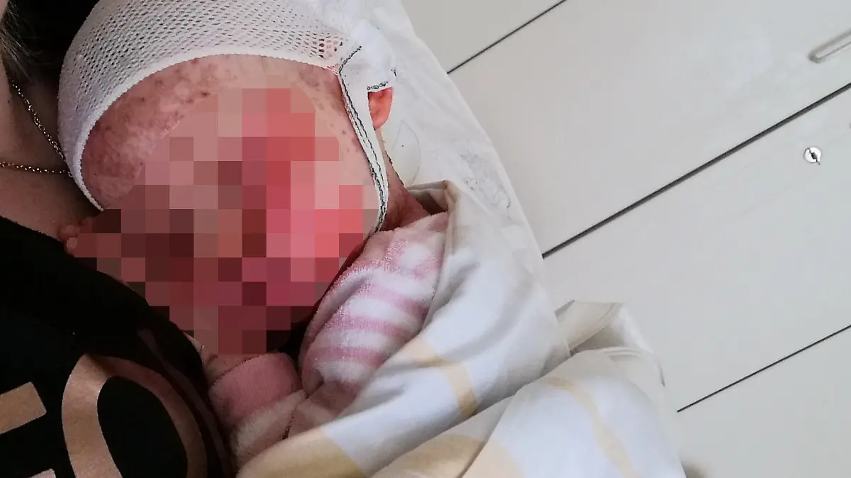 In letzter Not gerettet. Emma hatte mit straken Hautausschlägen zu kämpfen. Kliniken lehnten sie dennoch ab.