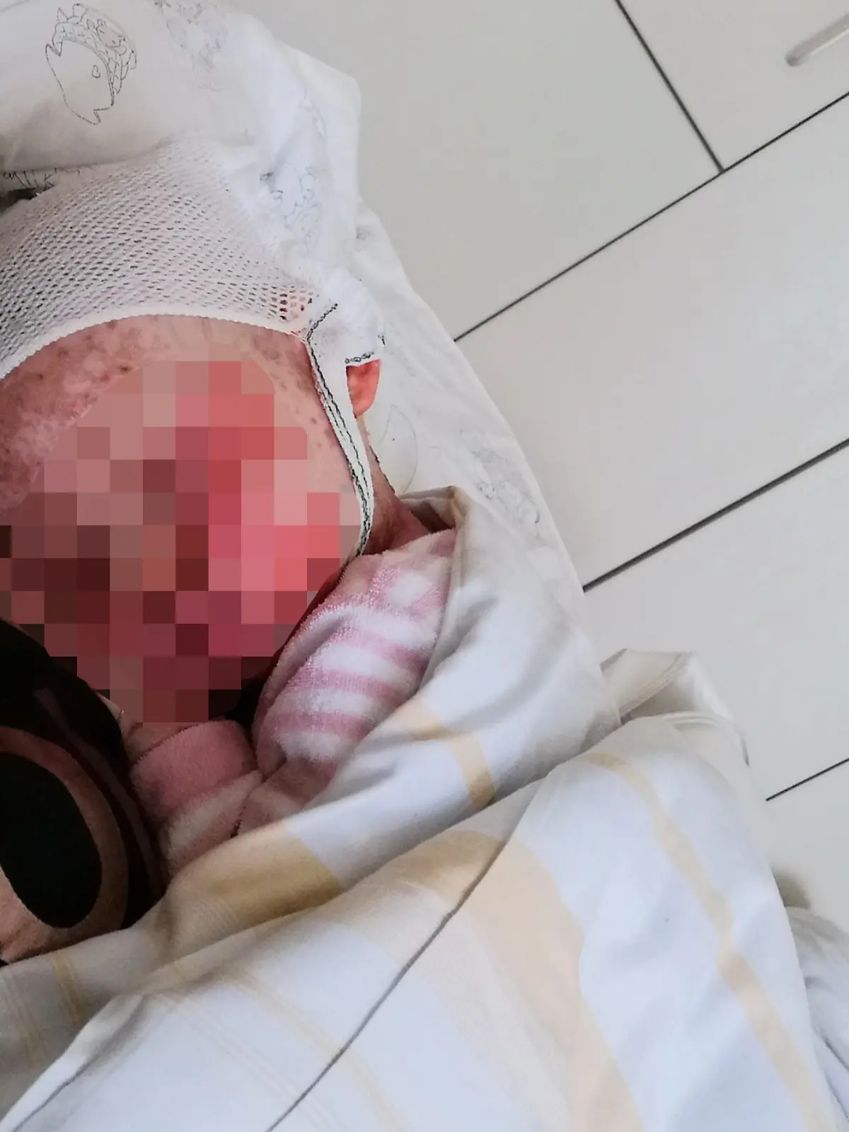 In letzter Not gerettet. Emma hatte mit straken Hautausschlägen zu kämpfen. Kliniken lehnten sie dennoch ab.