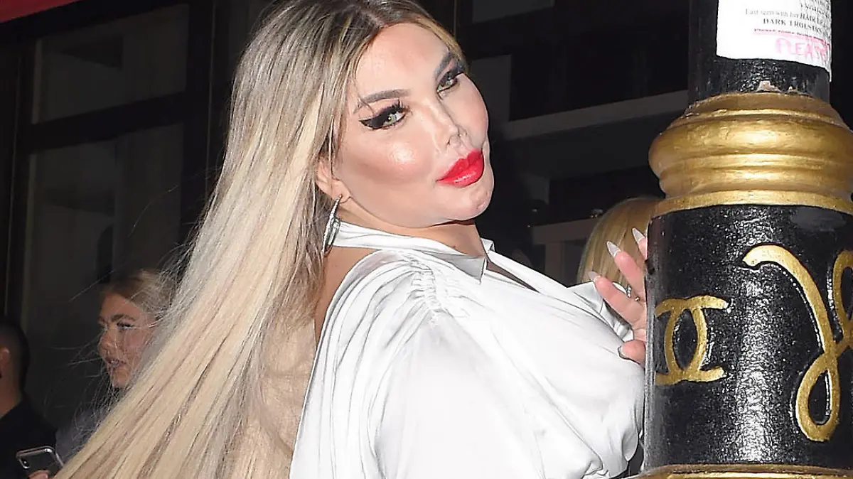Jessica Alves hat wegen der Einnahme weiblicher Hormone 30 Kilo zugenommen.