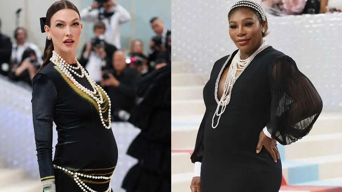 Karlie Kloss und Serena Williams sind wieder schwanger.