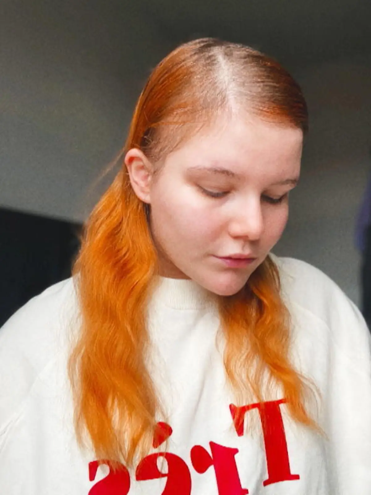 Bild zu: "Youtuberin verliert büschelweise Haare"