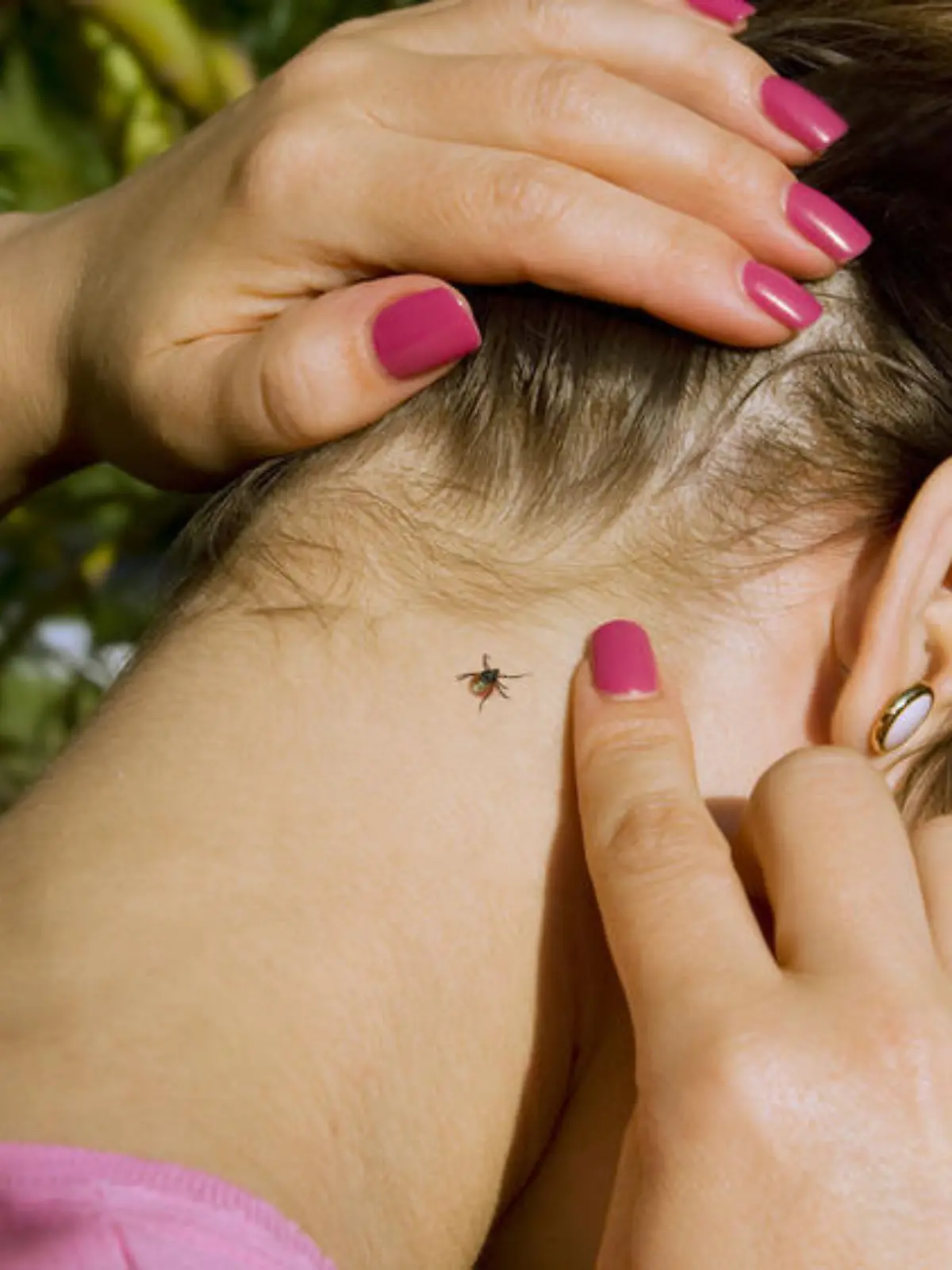 FSME vorbeugen: Frühsommerzecke ist auf dem Vormarsch