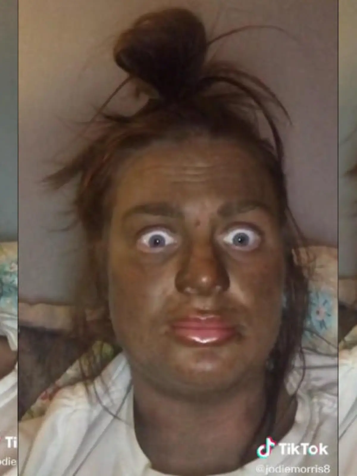 Jodie Morris aus Leeds mit Selbstbräuner-Fail im Gesicht