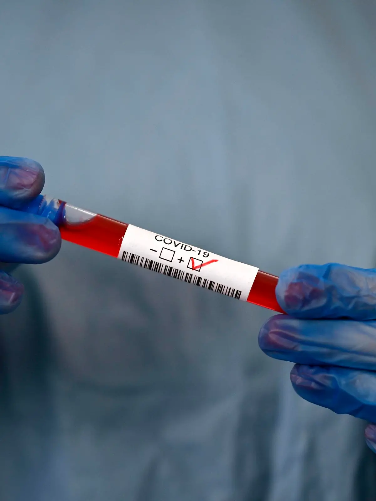  Positives Testergebnis, medizinisches Personal beim RT-PCR, Real-time Reverse Transkriptase Polymerase-Kettenreaktion, Corona-Test, Corona-Krise, Baden-Württemberg, Deutschland, Europa *** Positive test result, medical staff at RT PCR, Real time Reverse Transcriptase Polymerase Chain Reaction, Corona Test, Corona Crisis, Baden Württemberg, Germany, Europe Copyright: imageBROKER/MichaelxWeber ibximw05909137.jpg Bitte beachten Sie die gesetzlichen Bestimmungen des deutschen Urheberrechtes hinsichtlich der Namensnennung des Fotografen im direkten Umfeld der Veröffentlichung!