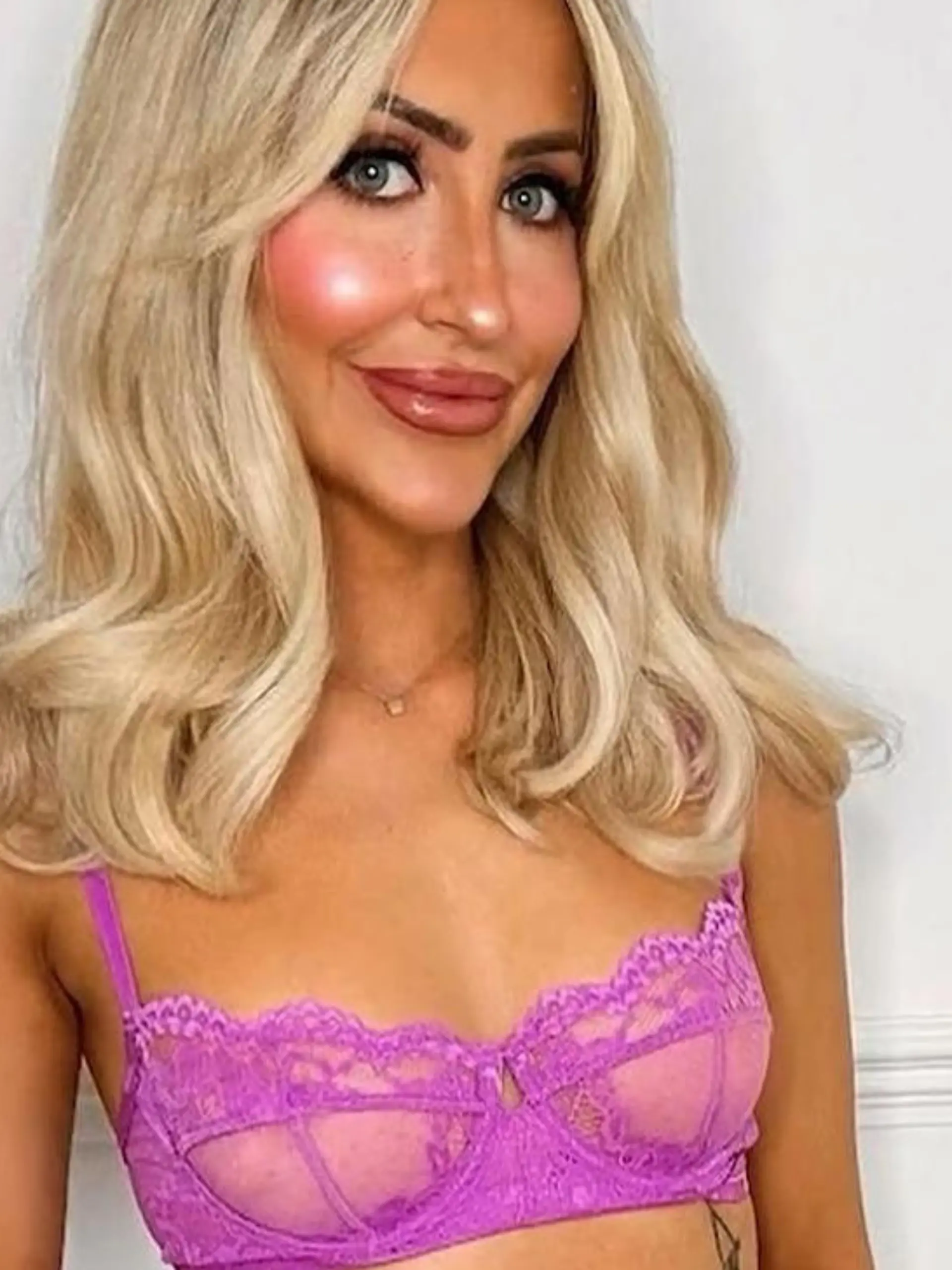 Sexy trotz Handicap! Holly (30) will ihren Stoma-Beutel nicht verstecken