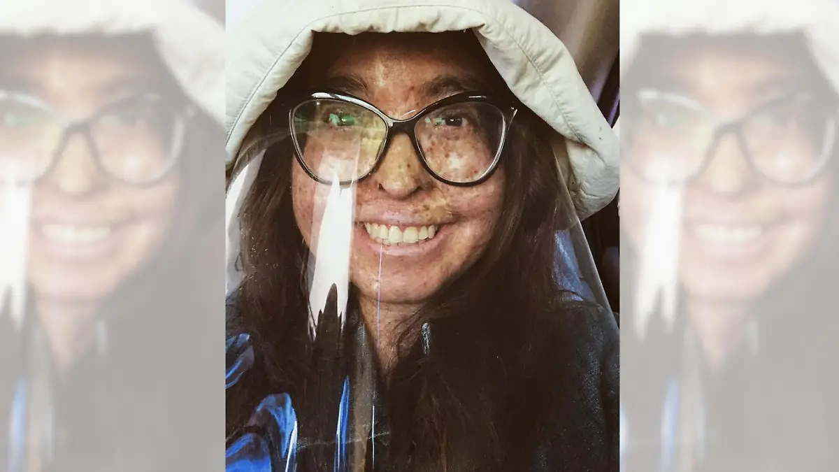 Die Mondscheinkrankheit führte bei Andrea Monroy schon mehrmals zu Hautkrebs