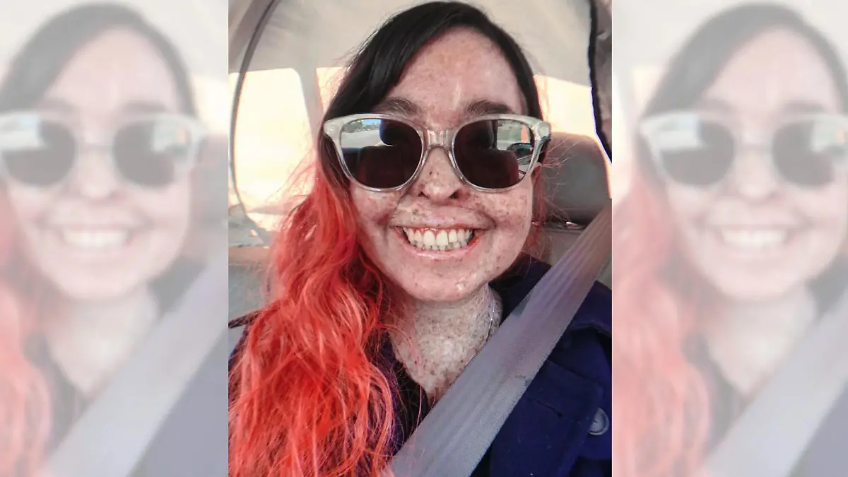 Die Mondscheinkrankheit führt bei ihr zum Krebs