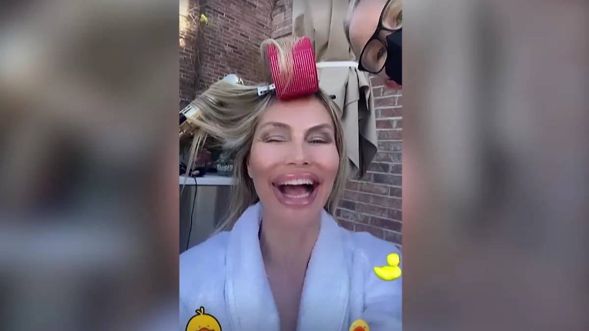 Plötzlich riskieren Promis ziemlich dicke Lippen Heidi, Tom & Co. haben Spaß mit "Pillow Face"