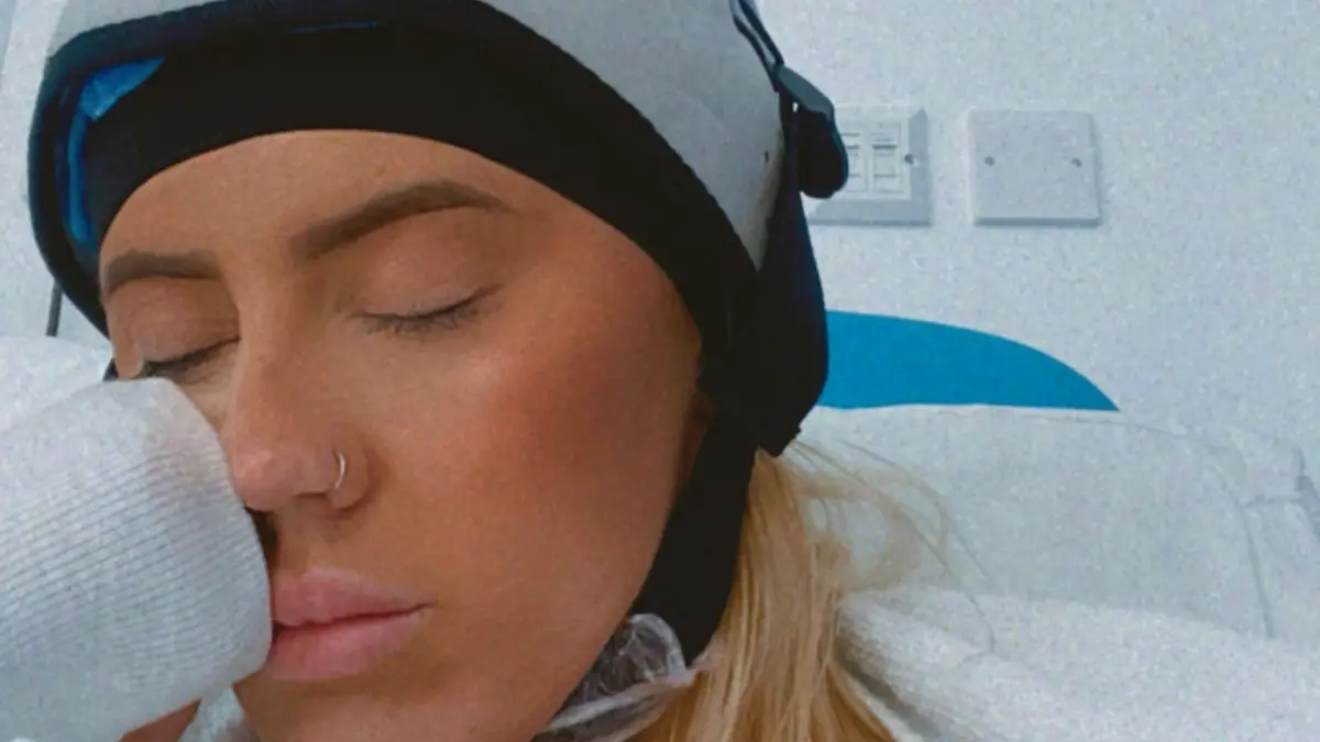 PIC FROM Kennedy News and Media (PICTURED: ALICIA MCGOOGAN (24) FROM MANCHESTER, GREATER MANCHESTER, WEARING A COLD CAP DURING CHEMOTHERAPY) A graduate claims she might not have had to have her breast removed aged just 23 had doctors not dismissed her as being 'too young' to have cancer. Alicia Mcgoogan said she started feeling pain and discomfort in her right breast in December 2021, which she thought was just from her time of the month. But when her nipple started leaking a yellow-sticky discharge she booked an appointment with her GP and was eventually transferred to the breast clinic at Burnley General Teaching Hospital. DISCLAIMER: While Kennedy News and Media uses its best endeavours to establish the copyright and authenticity of all pictures supplied, it accepts no liability for any damage, loss or legal action caused by the use of images supplied and the publication of images is solely at your discretion. SEE KENNEDY NEWS COPY - 0161 697 4266