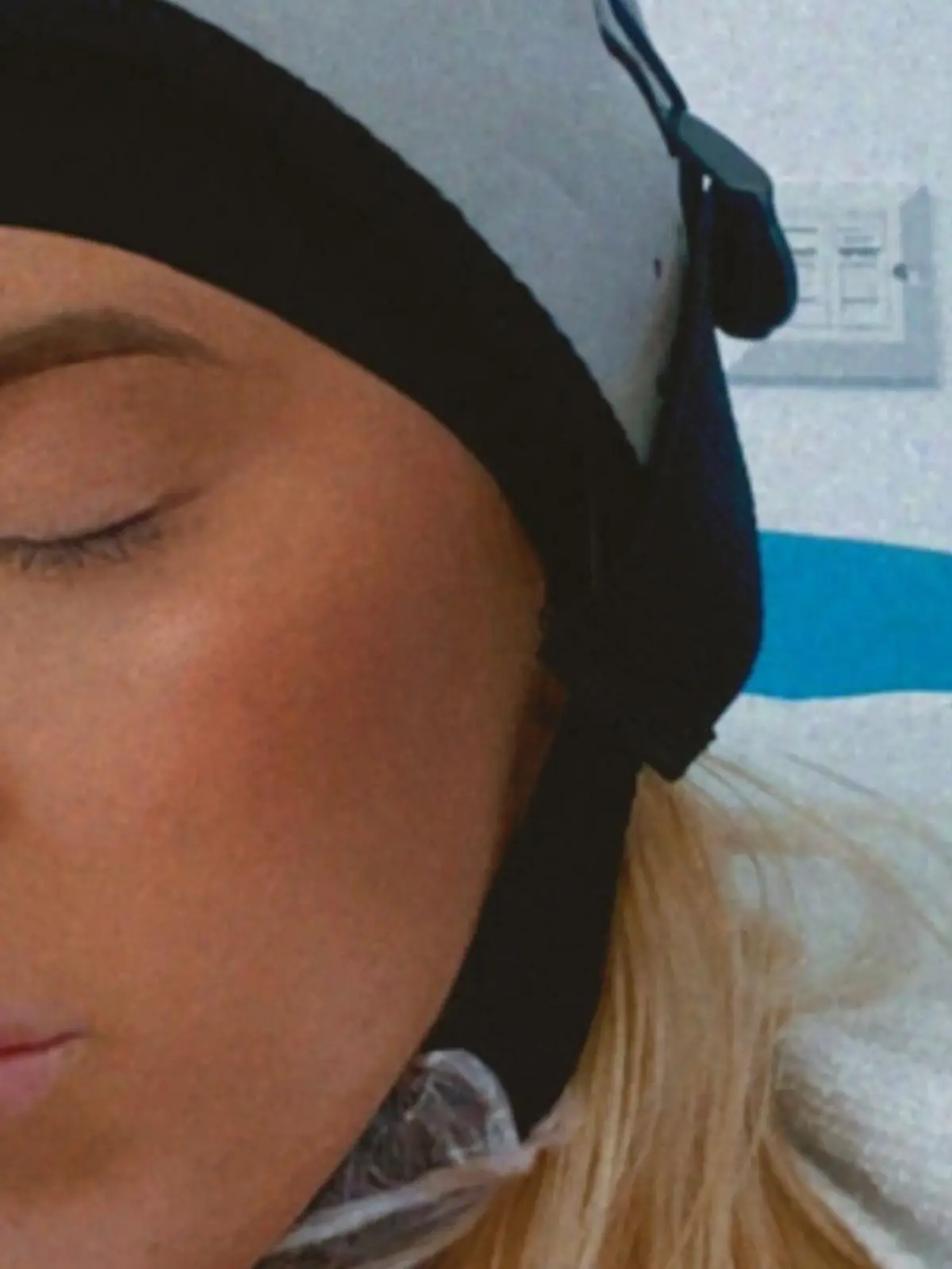 PIC FROM Kennedy News and Media (PICTURED: ALICIA MCGOOGAN (24) FROM MANCHESTER, GREATER MANCHESTER, WEARING A COLD CAP DURING CHEMOTHERAPY) A graduate claims she might not have had to have her breast removed aged just 23 had doctors not dismissed her as being 'too young' to have cancer. Alicia Mcgoogan said she started feeling pain and discomfort in her right breast in December 2021, which she thought was just from her time of the month. But when her nipple started leaking a yellow-sticky discharge she booked an appointment with her GP and was eventually transferred to the breast clinic at Burnley General Teaching Hospital. DISCLAIMER: While Kennedy News and Media uses its best endeavours to establish the copyright and authenticity of all pictures supplied, it accepts no liability for any damage, loss or legal action caused by the use of images supplied and the publication of images is solely at your discretion. SEE KENNEDY NEWS COPY - 0161 697 4266