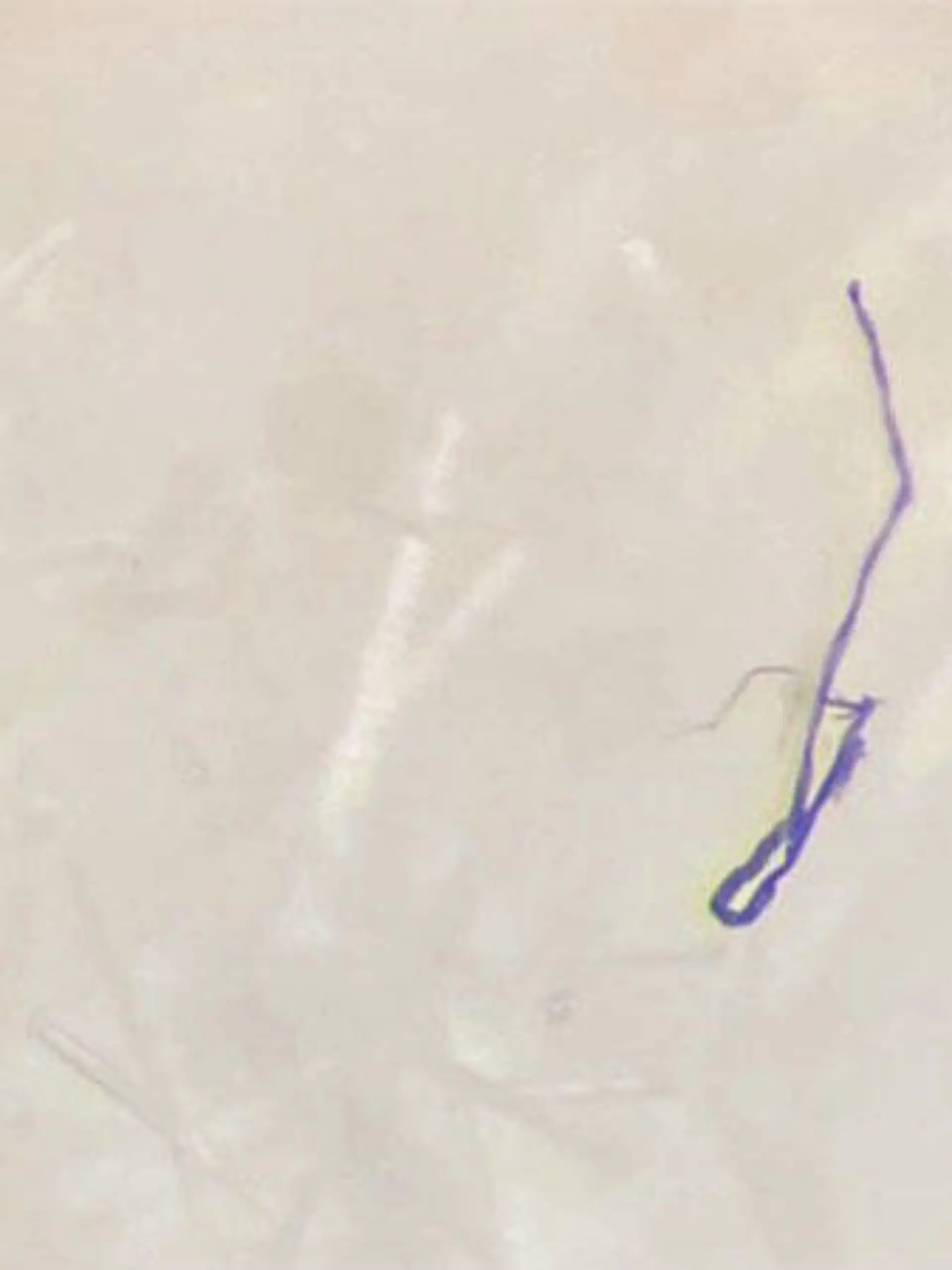 Forensiker und Kriminalbiologe Dr. Mark Benecke untersucht Fasern