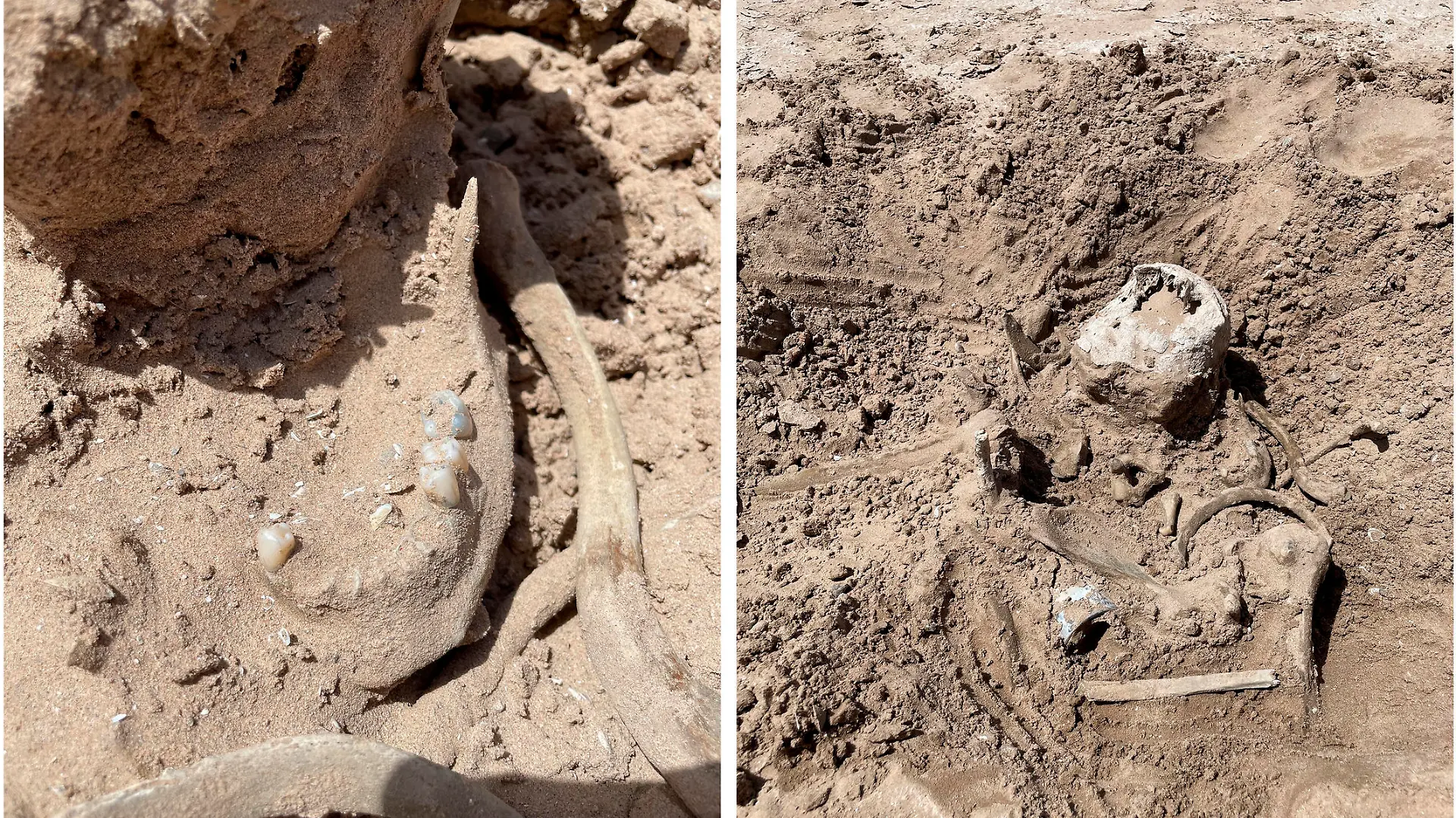 These photos of Saturday, May 7, 2022, provided by Lindsey Melvin of Henderson, Nev., shows human remains she and her sister discovered on a sandbar that recently surfaced as Lake Mead recedes. A closer look revealed a human jaw with teeth. The National Park Service confirmed in a statement that the bones are human. (Lindsey Melvin via AP)