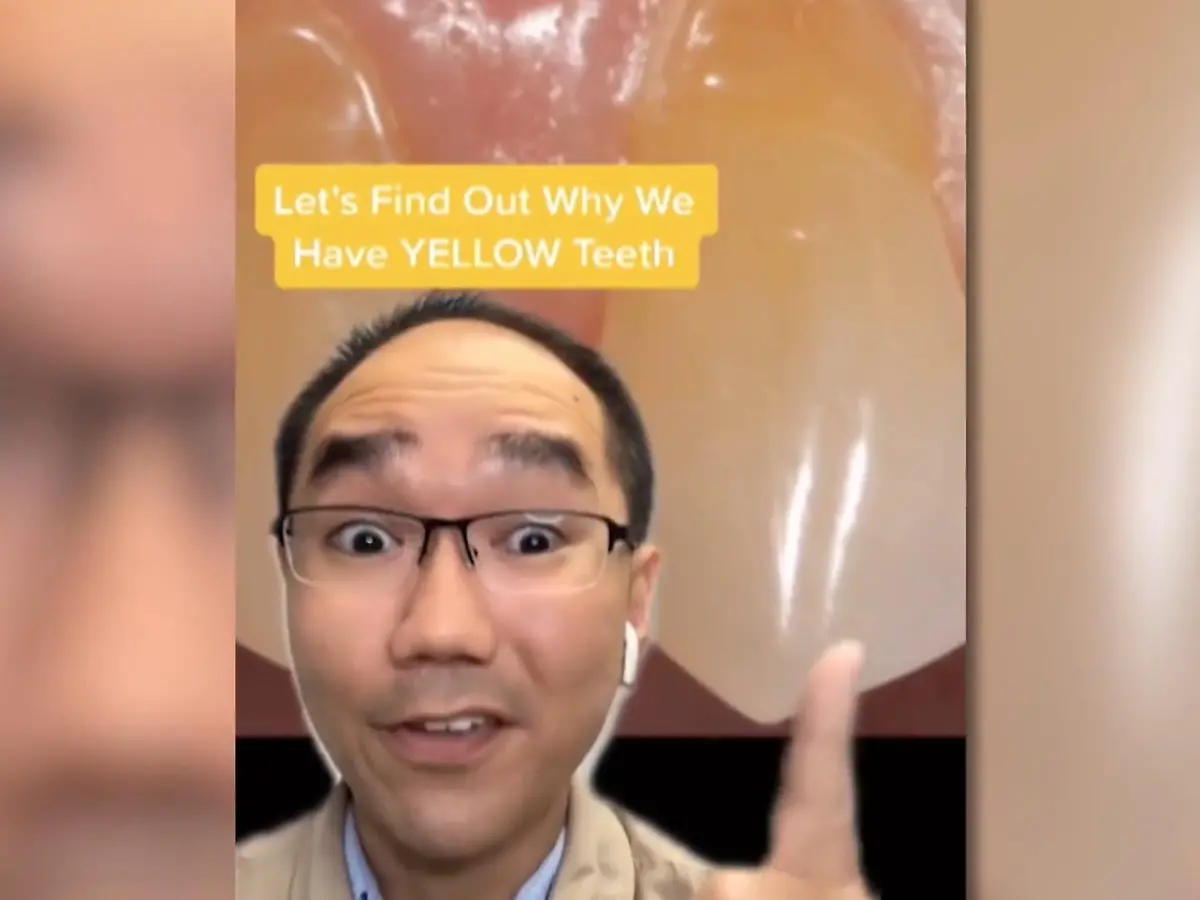 Lieber sanft putzen, statt schrubben!: TikTok-Doc: Gelbe Zhne durchs zu  starkes Zhneputzen!