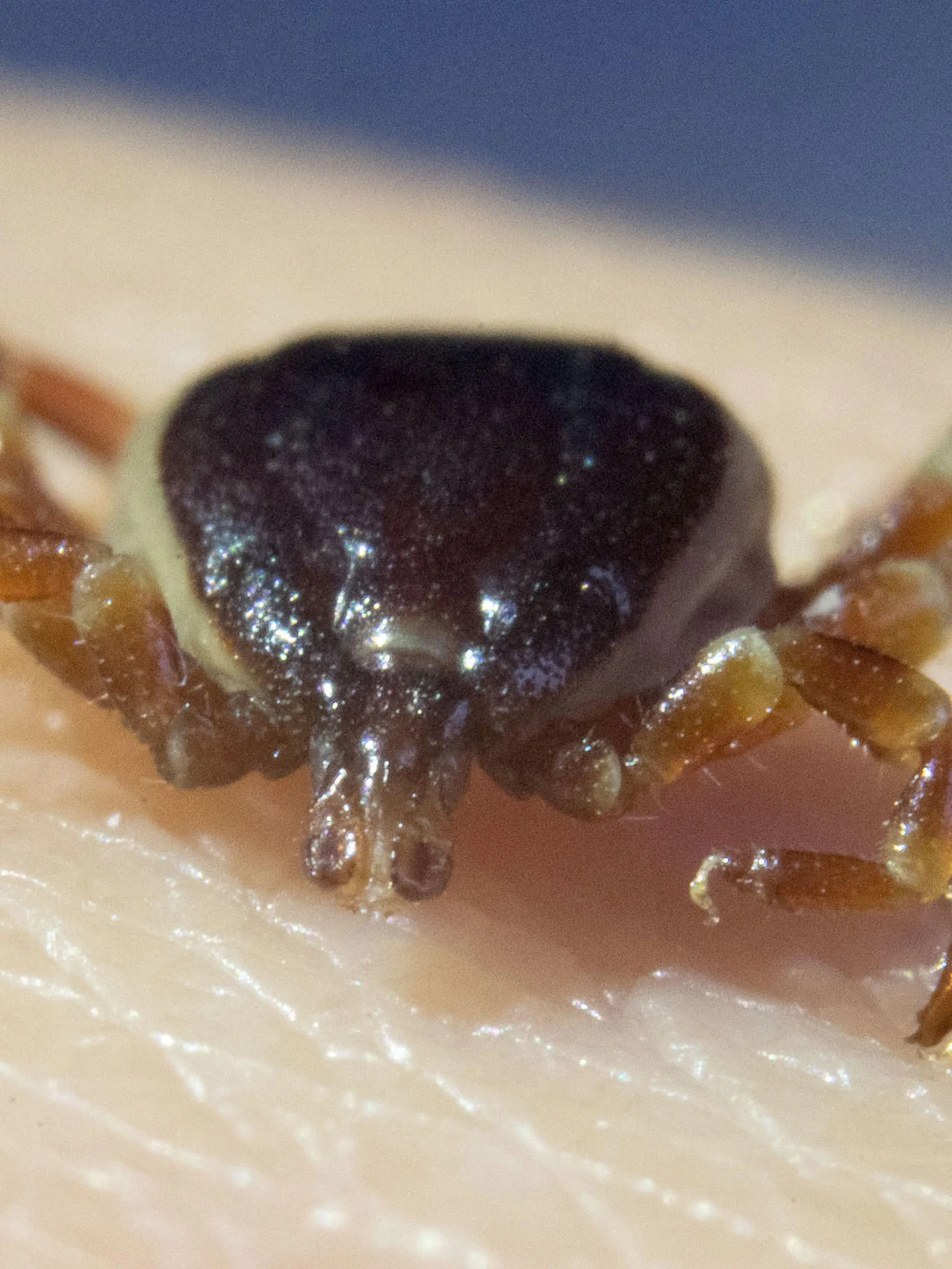 Eine tote Zecke Hyalomma marginatum sitzt in der Parasitologie der Universität Hohenheim auf der Hand einer Doktorandin. (zu dpa "Weniger FSME-Fälle nach Zeckenstichen - starker Rückgang im Süden")