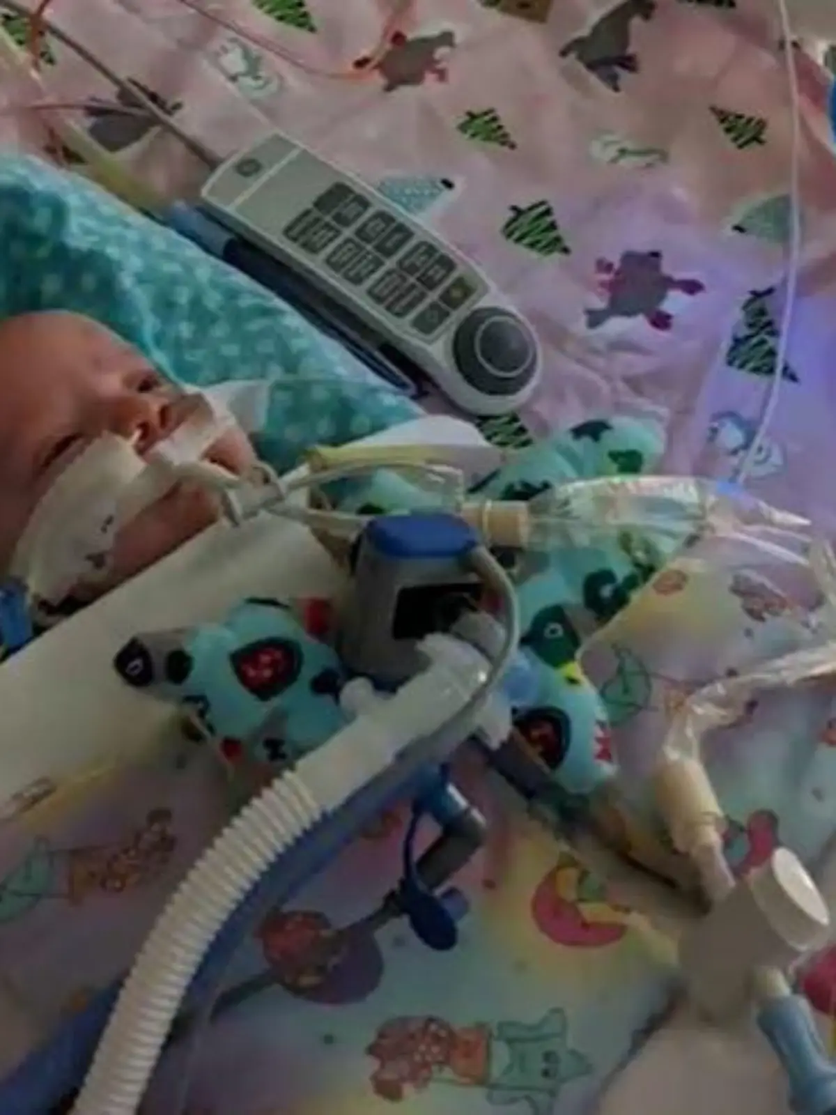 Baby Everly hatte mit nur sieben Wochen einen Herzinfarkt.