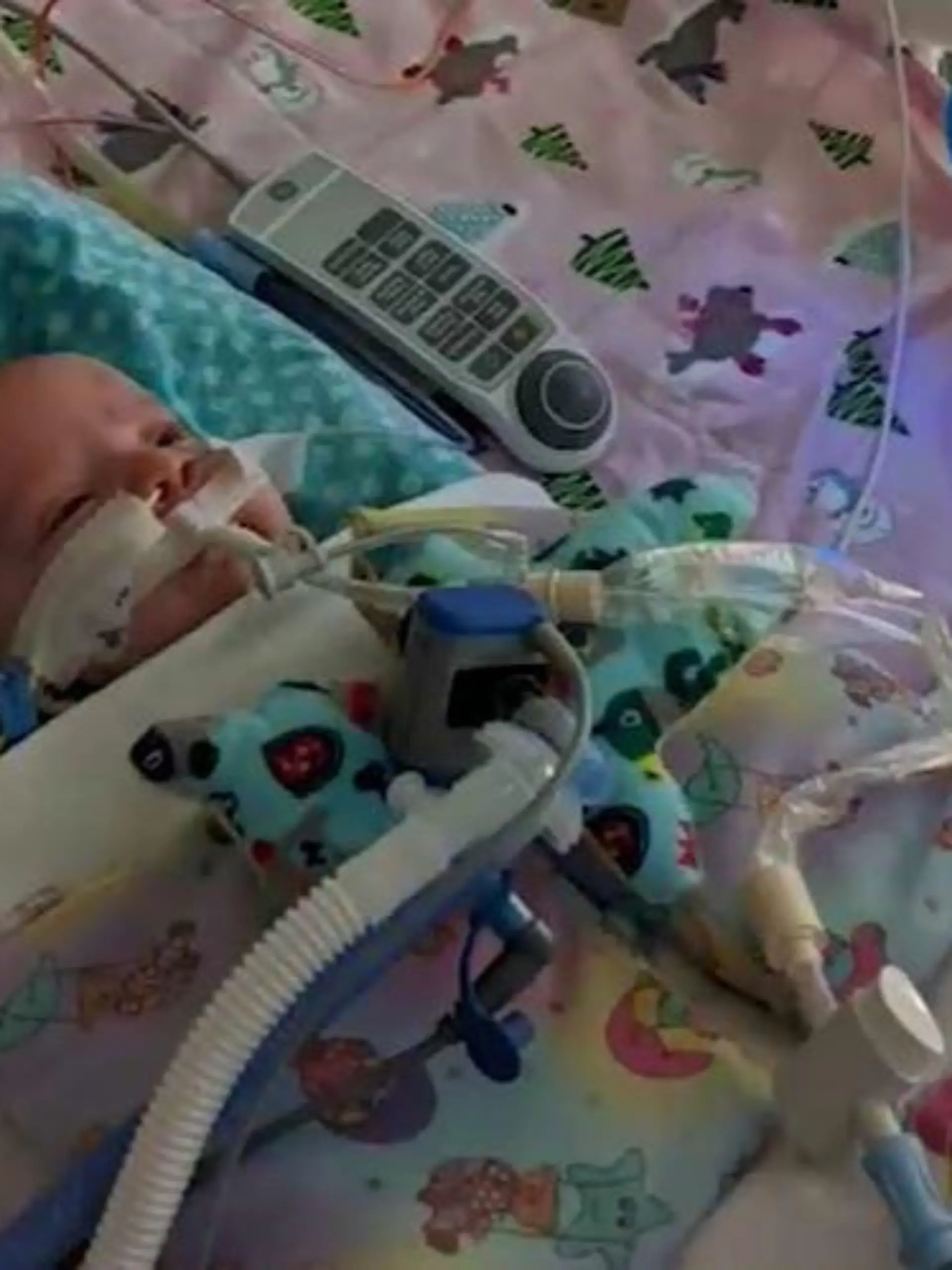 Baby Everly hatte mit nur sieben Wochen einen Herzinfarkt.