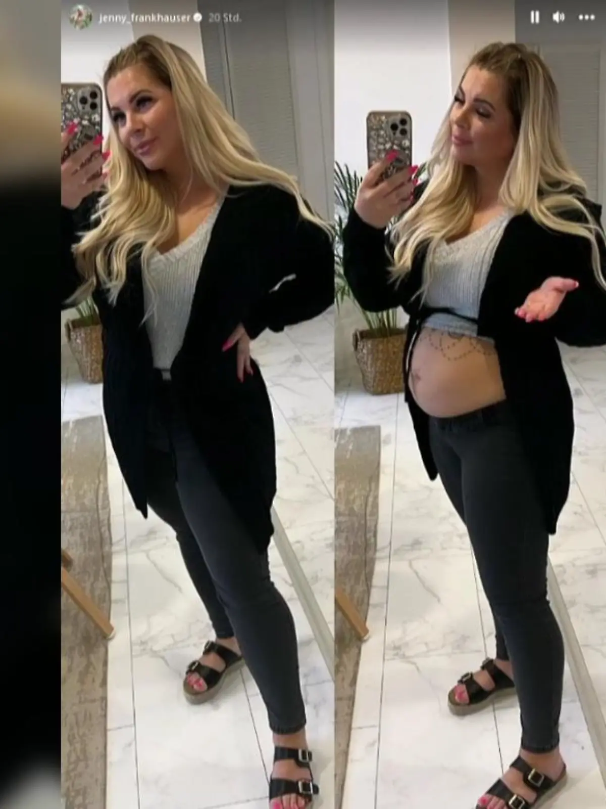 Jenny Frankhauser zeigt ihren After-Baby-Body - sieben Monate nach der Geburt ihres Sohnes.